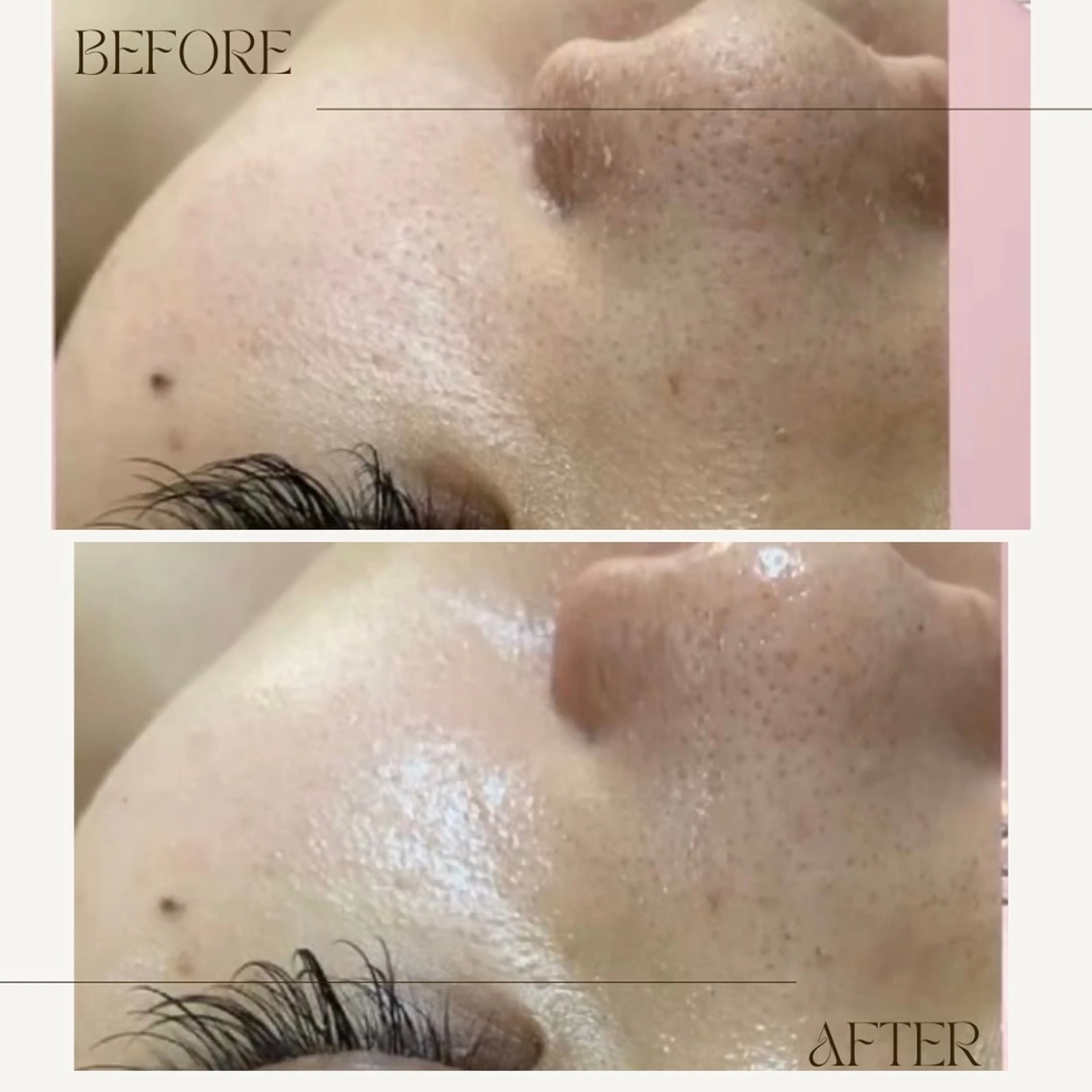 エステ ニキビ毛穴専門店Beautysalon Luana所属・小林 まいのエステ・リラクイメージ