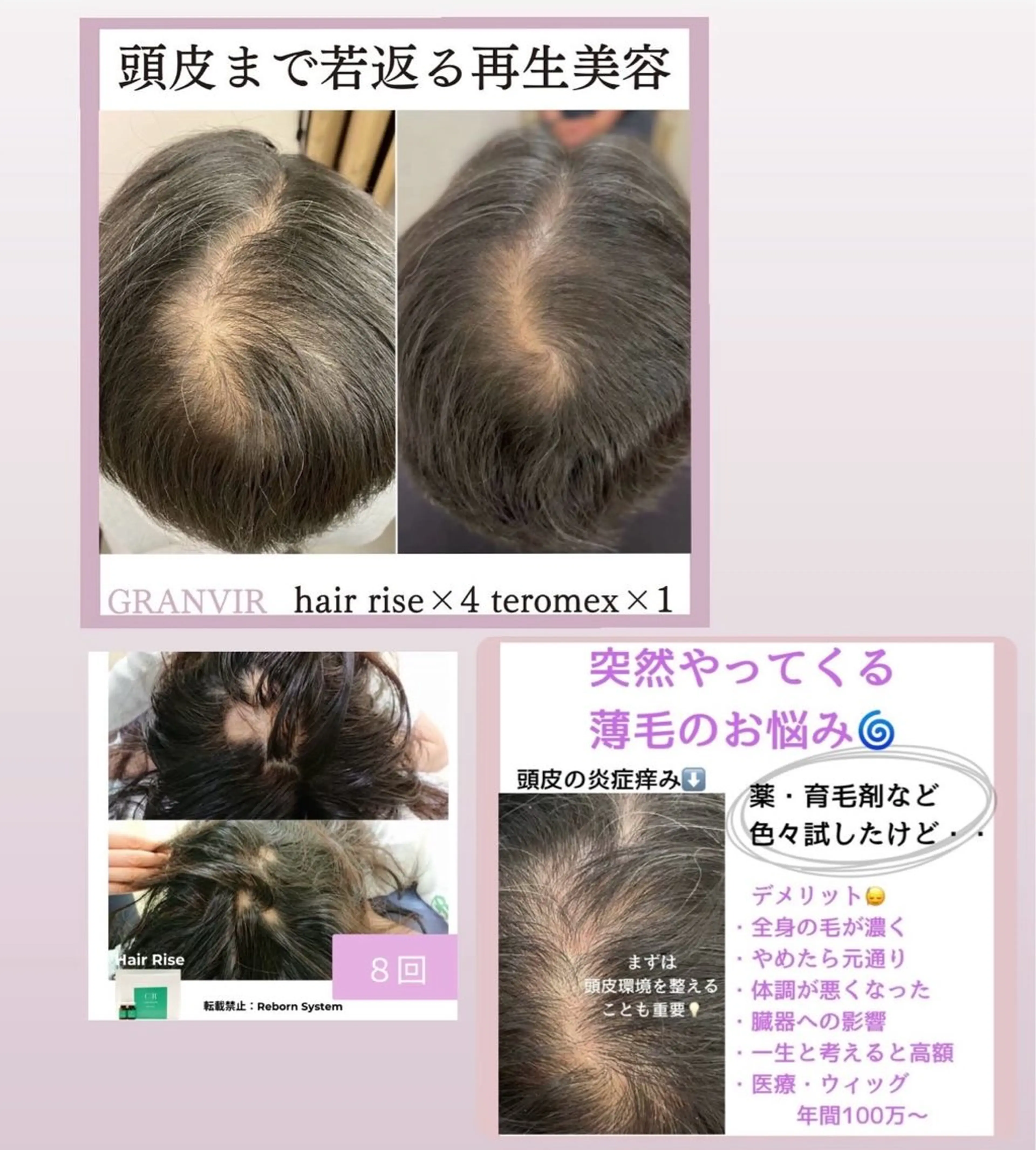 【福岡市西区 エステ】 GRANVIR(グランヴィール)所属・GRANVIR グランヴィールのエステ・リラクイメージ