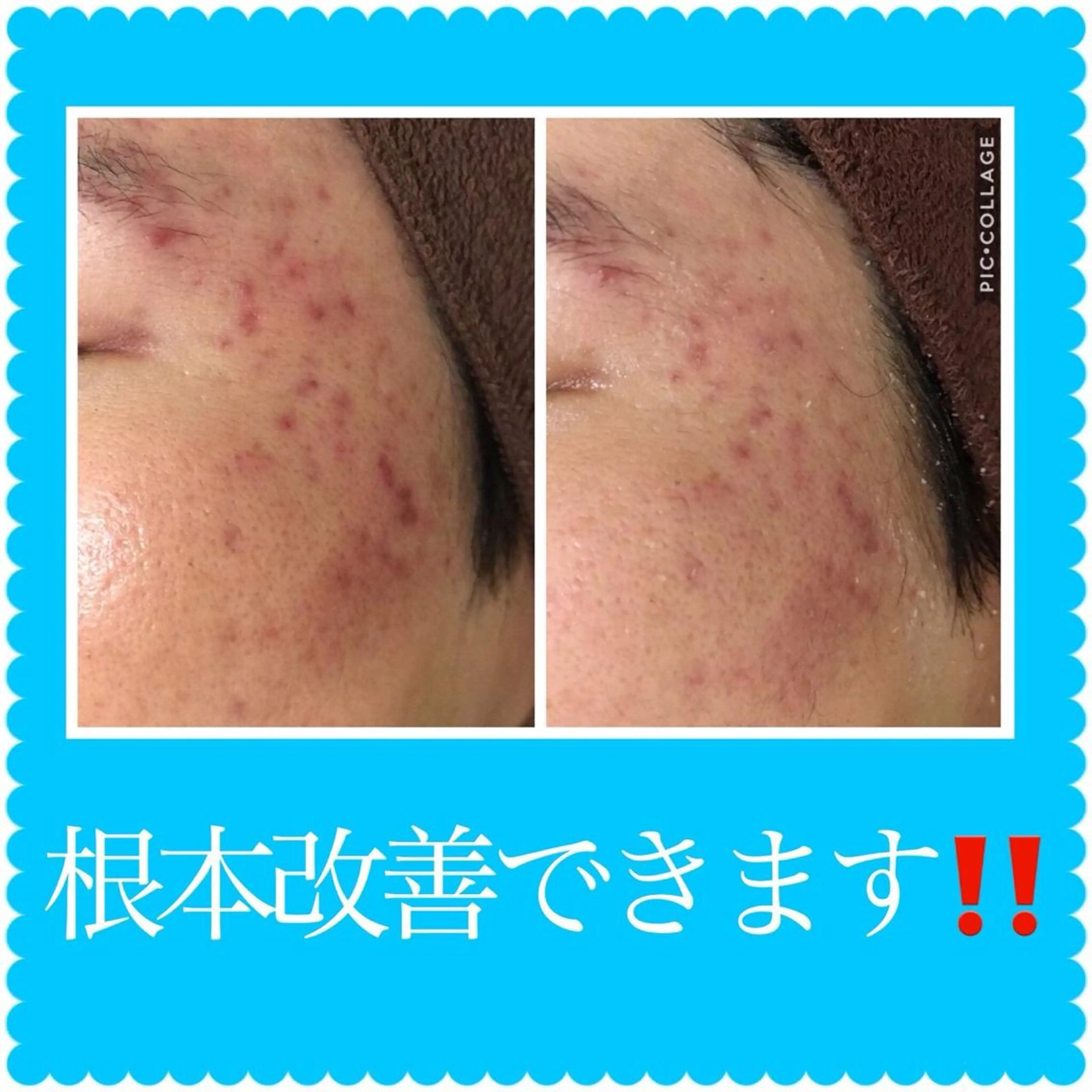 ミディアム カラー パーマ ヘアアレンジ メンズ キッズ ネイル マツエク・マツパ ニキビ・肌質改善専門 ♡人生が変わるサロンのエステ・リラクイメージ