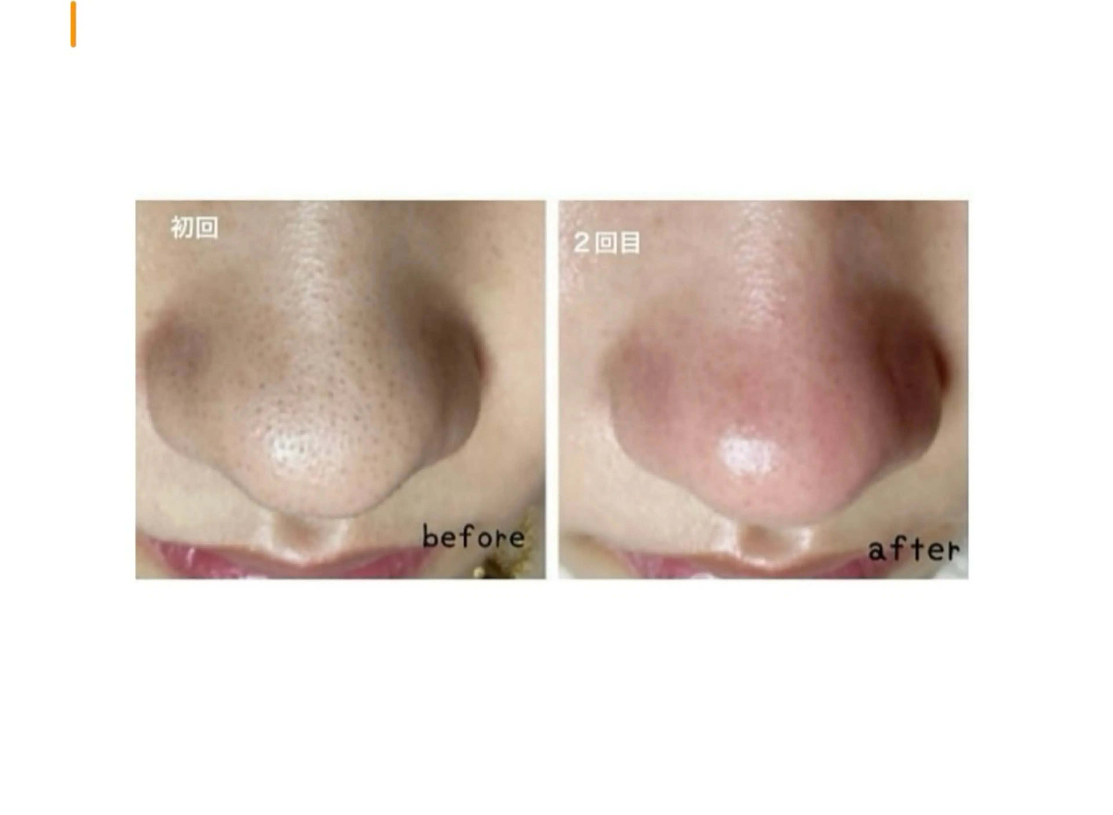 痩身Salon Charmeのエステ・リラクイメージ