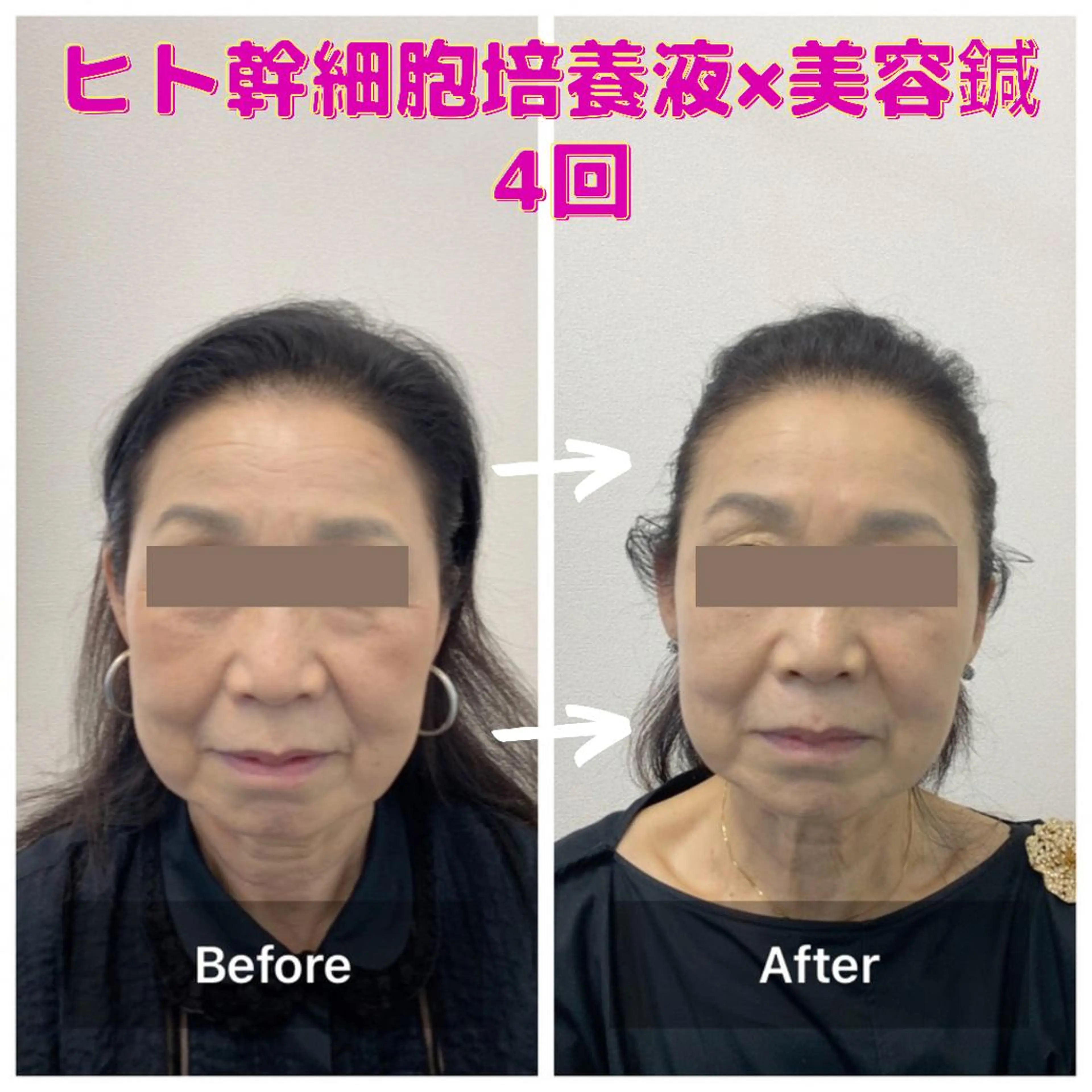 エステ gomi sayakaのエステ・リラクイメージ