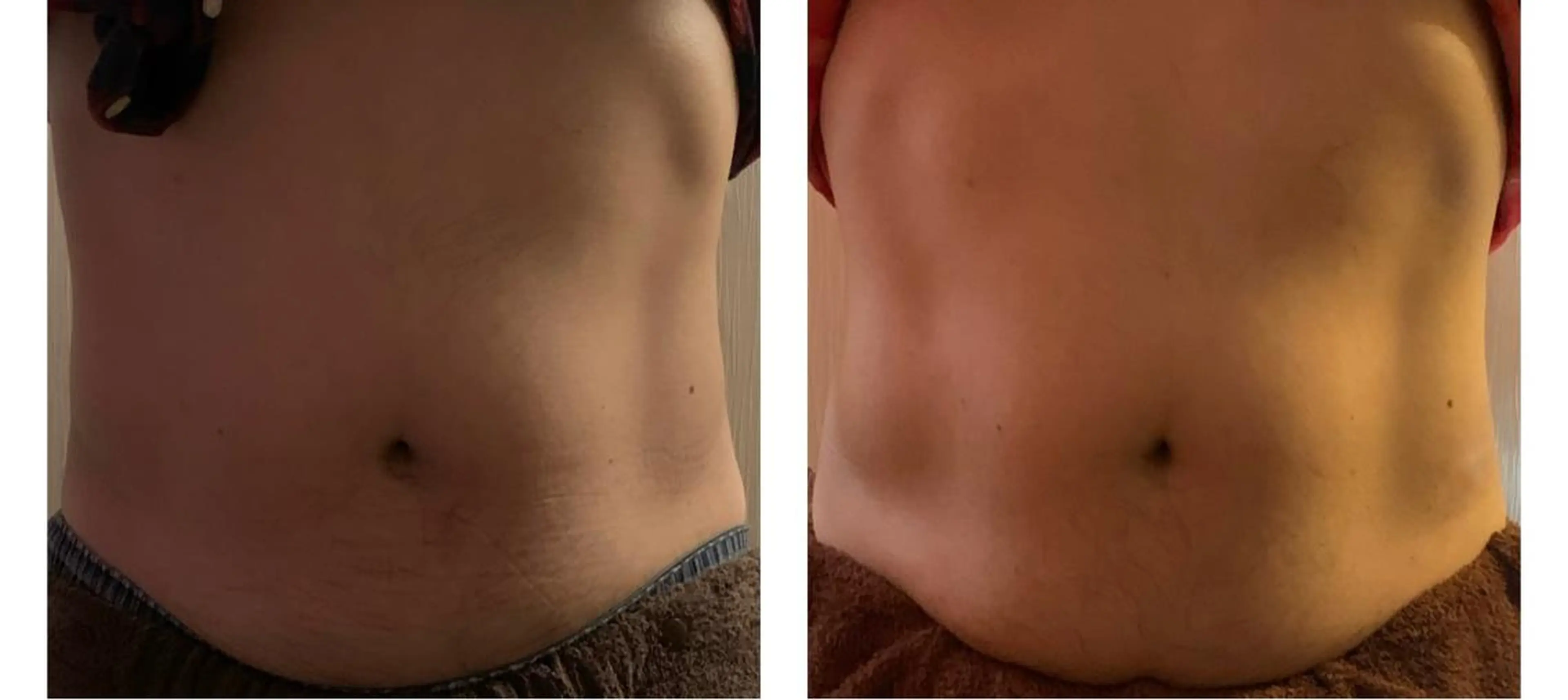 メンズ エステ 癒し腸もみサロン シャユーム　ゆきなのエステ・リラクイメージ