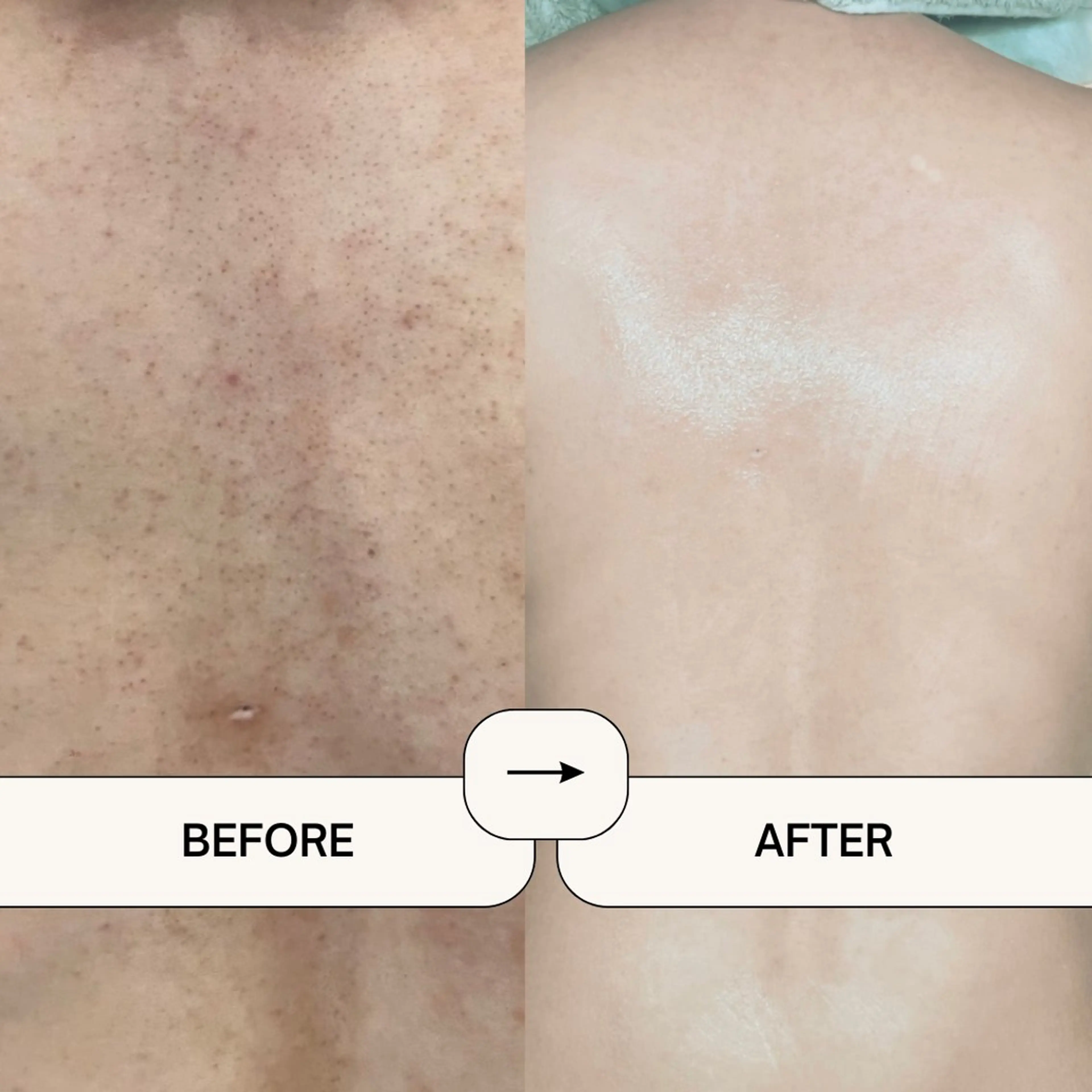 エステ サロンド エルのエステ・リラクイメージ