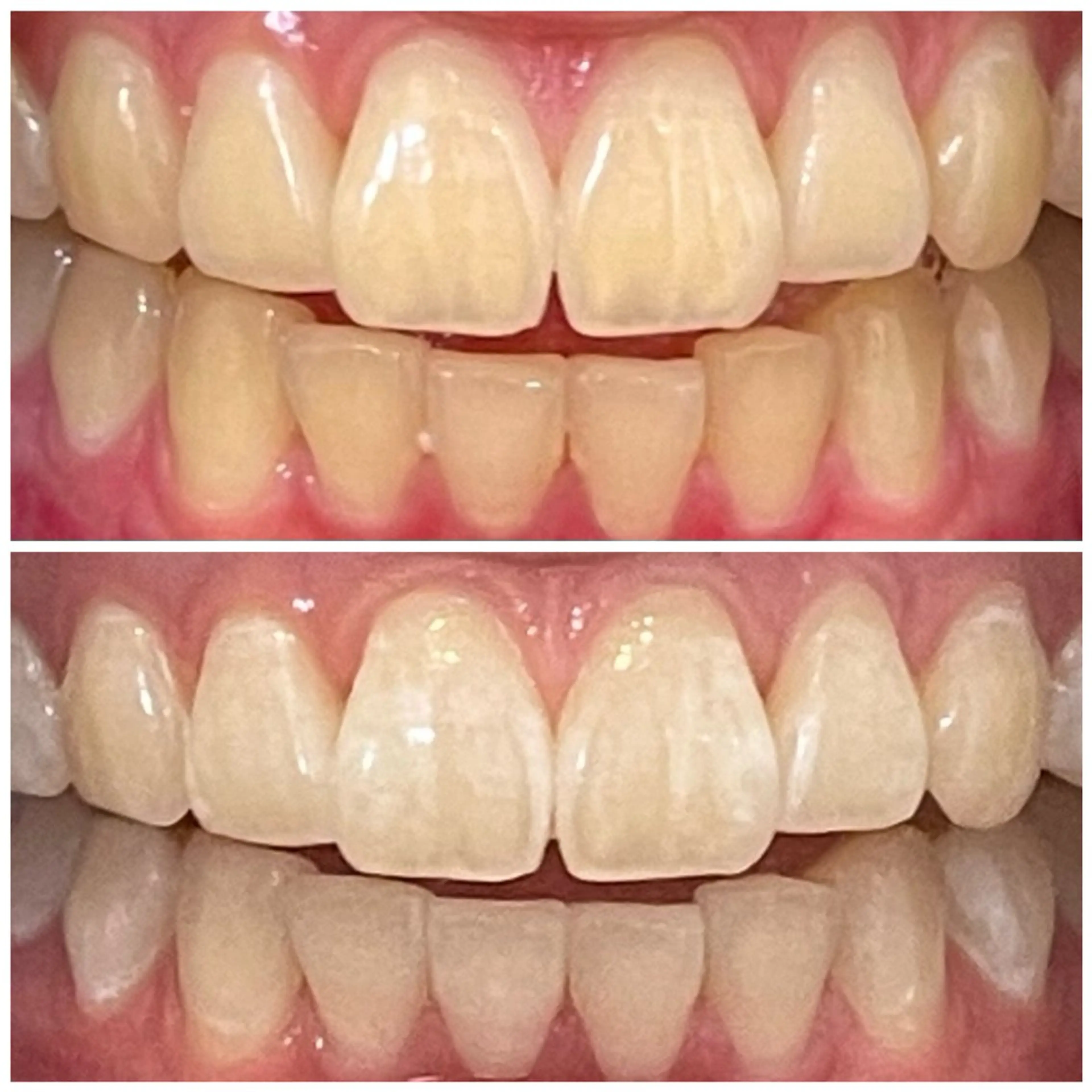 DIAMOND BEAUYのその他イメージ