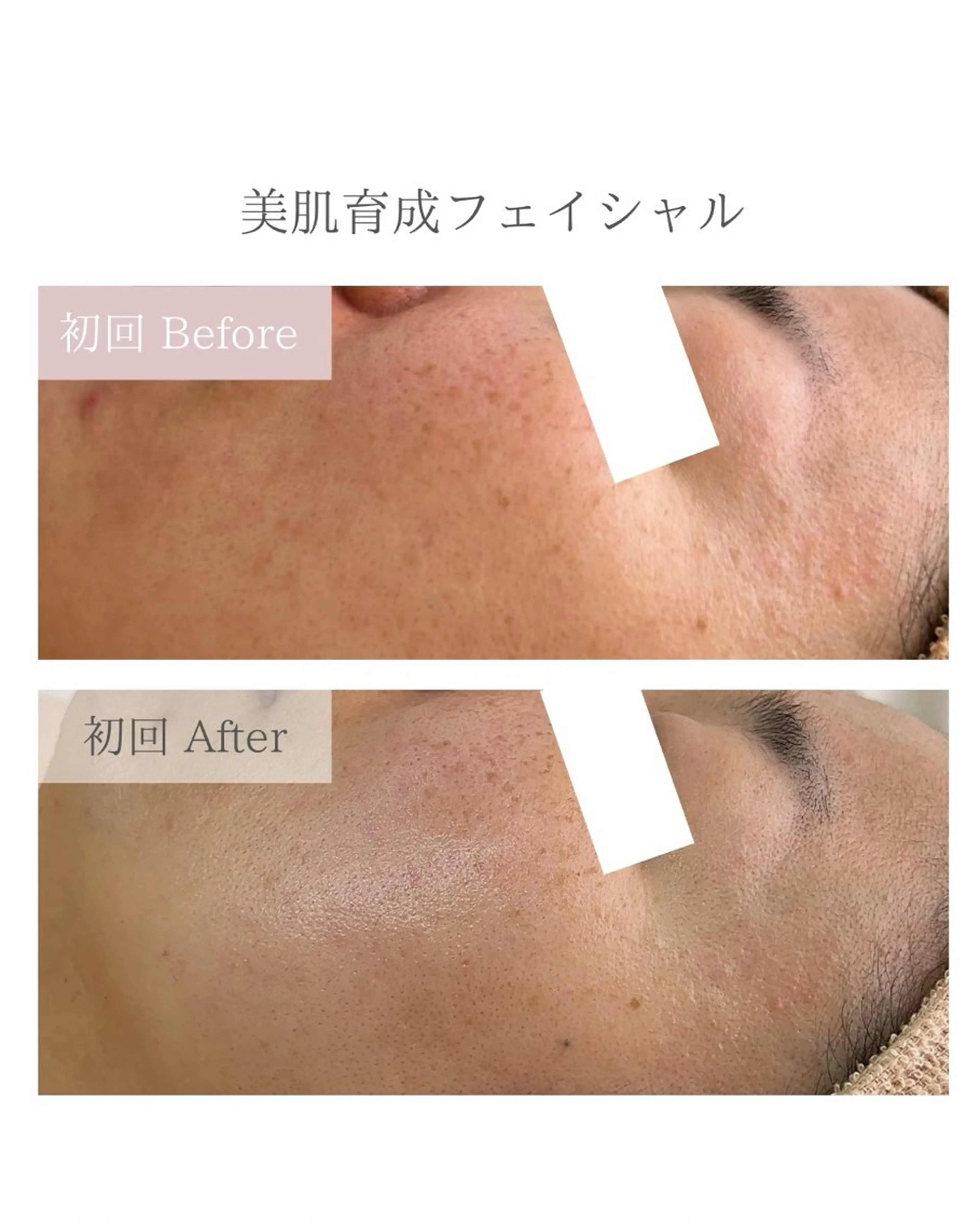 毛穴肌管理サロン ラクシュミーのエステ・リラクイメージ