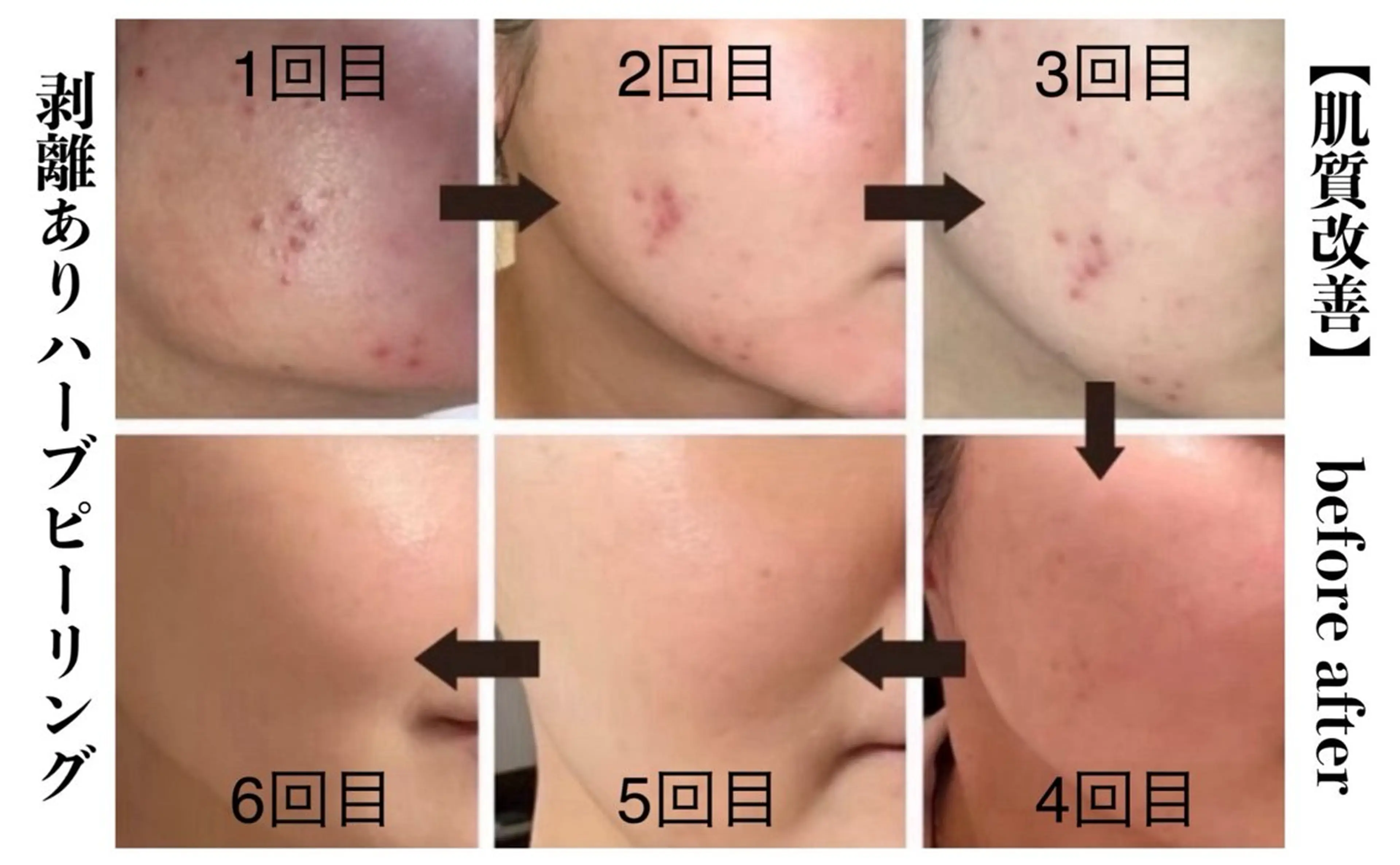 NHerb【エヌハーブ】所属・横田 汐里のネイルデザイン