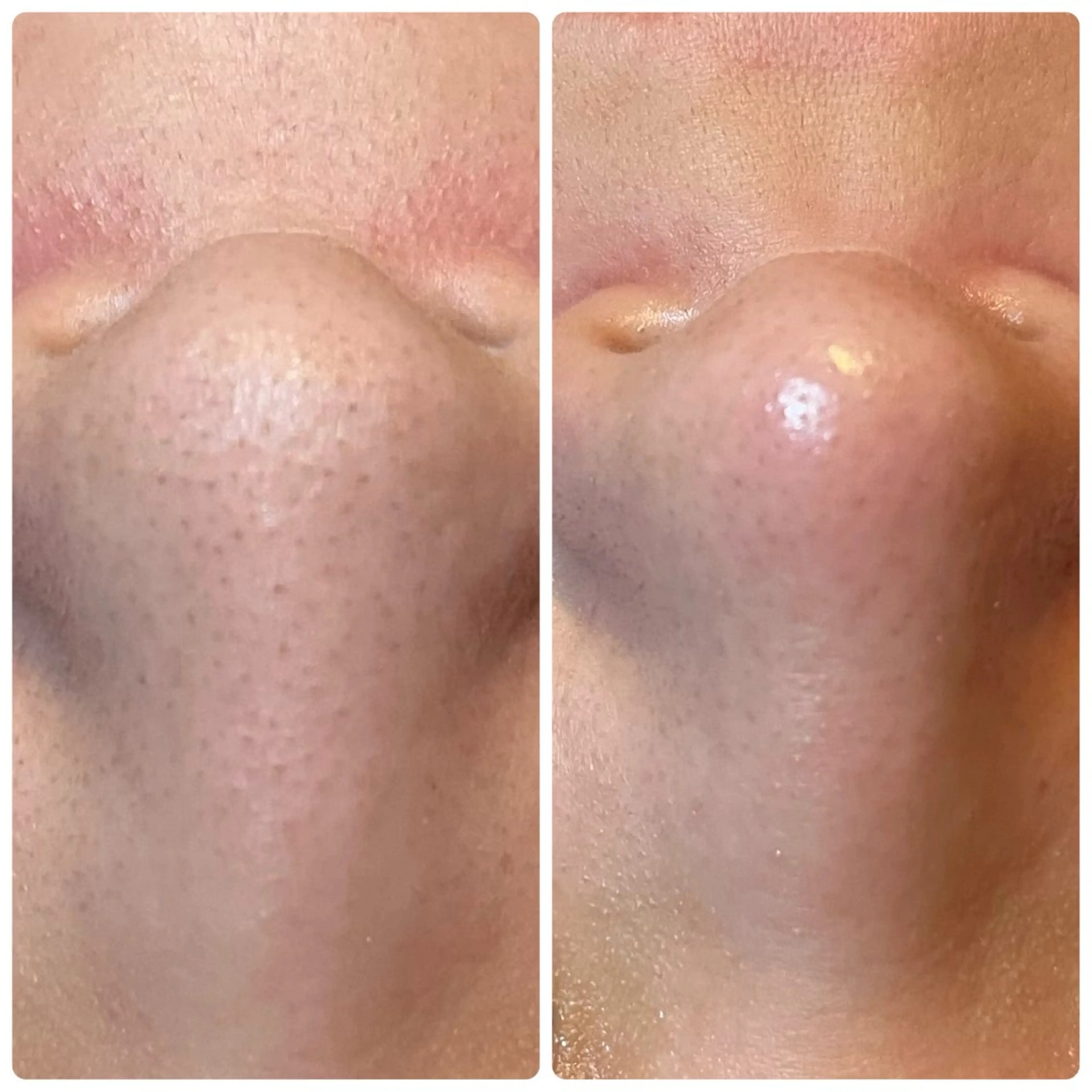 salon akua nail＆リラクのマツエク・マツパデザイン