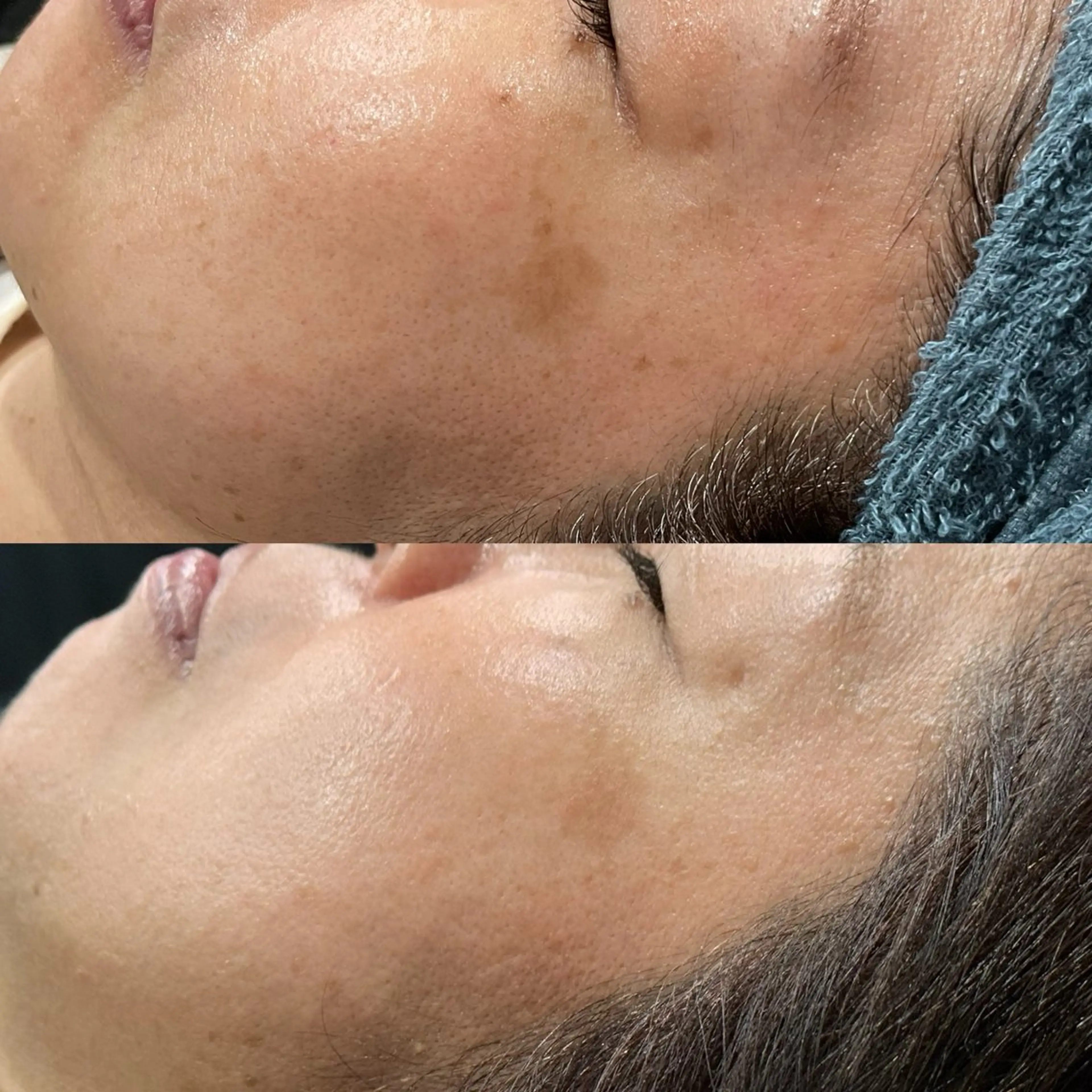 エステ LiZA エステティックサロンのエステ・リラクイメージ