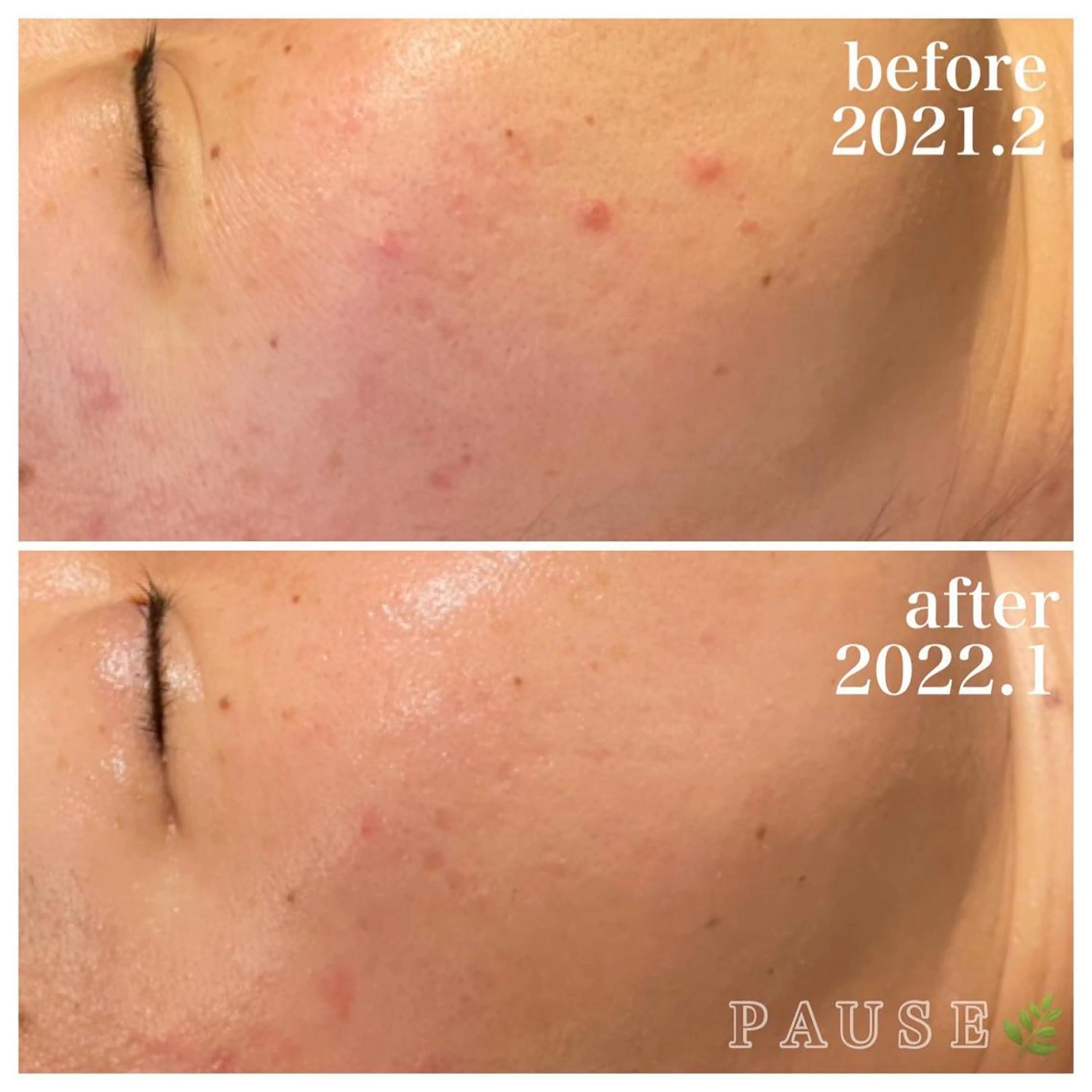 エステ 浜野 恵美のエステ・リラクイメージ