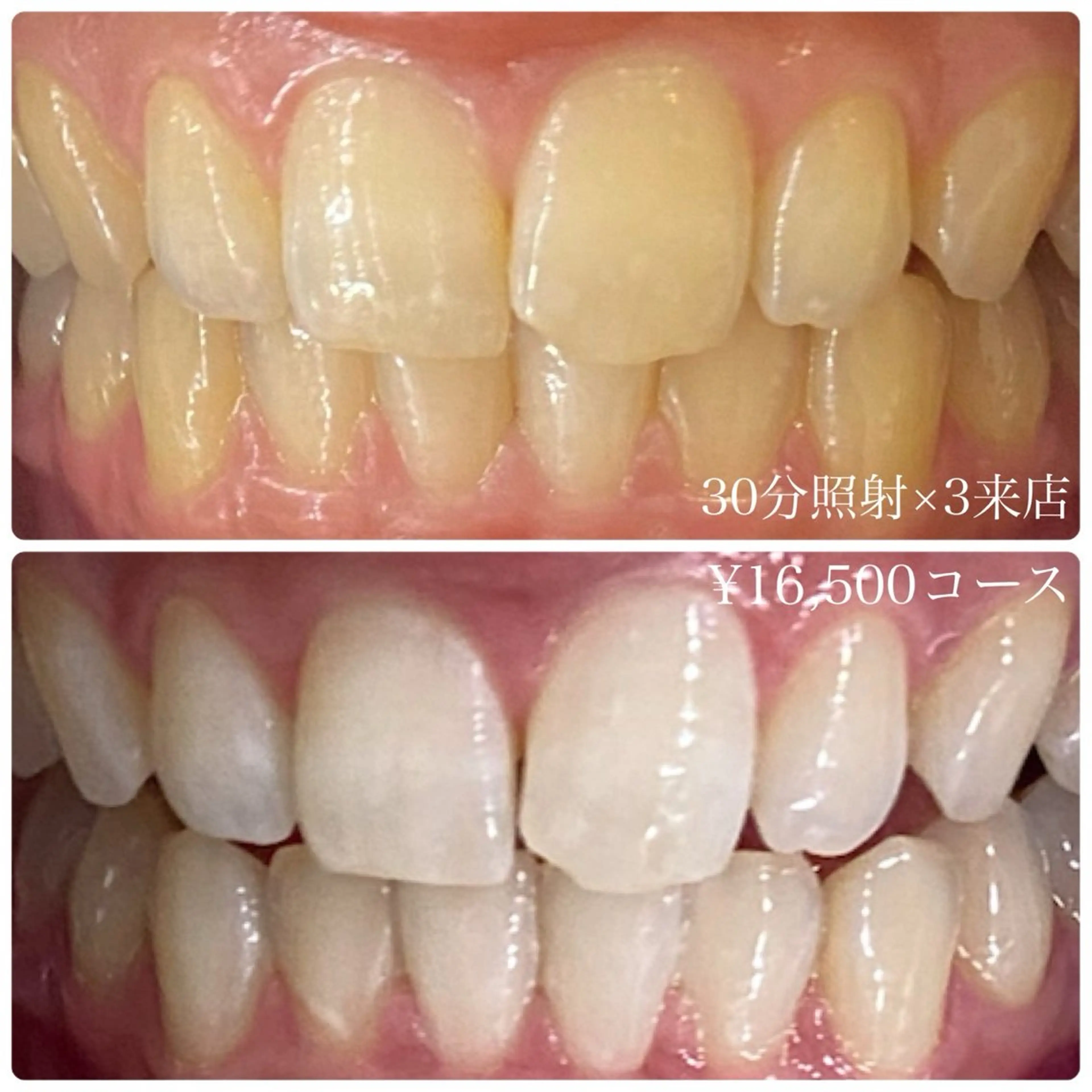 ホワイトニングルーム 横浜店のその他イメージ