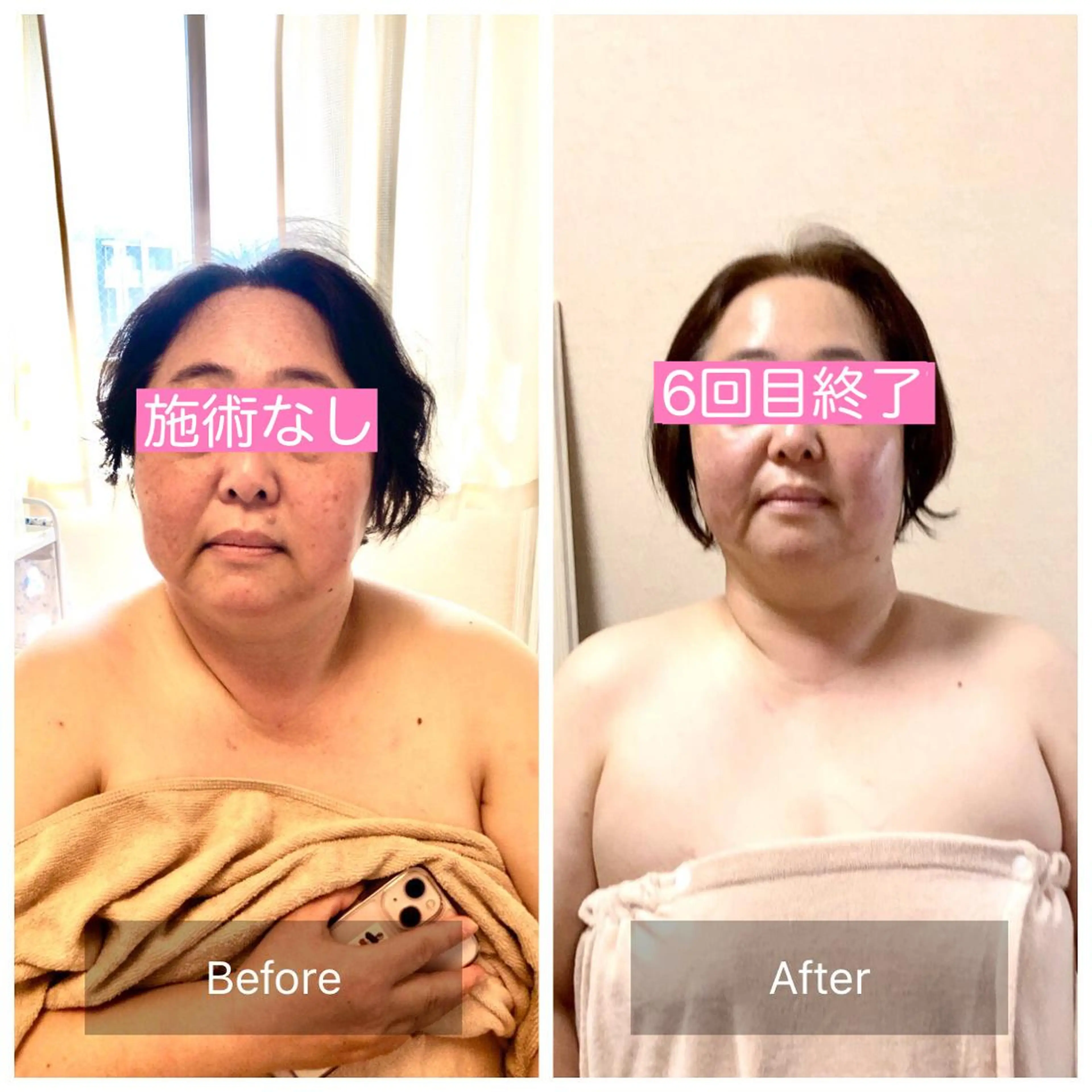 エステ リラク 小顔矯正&ヘッドスパ haruhandのエステ・リラクイメージ
