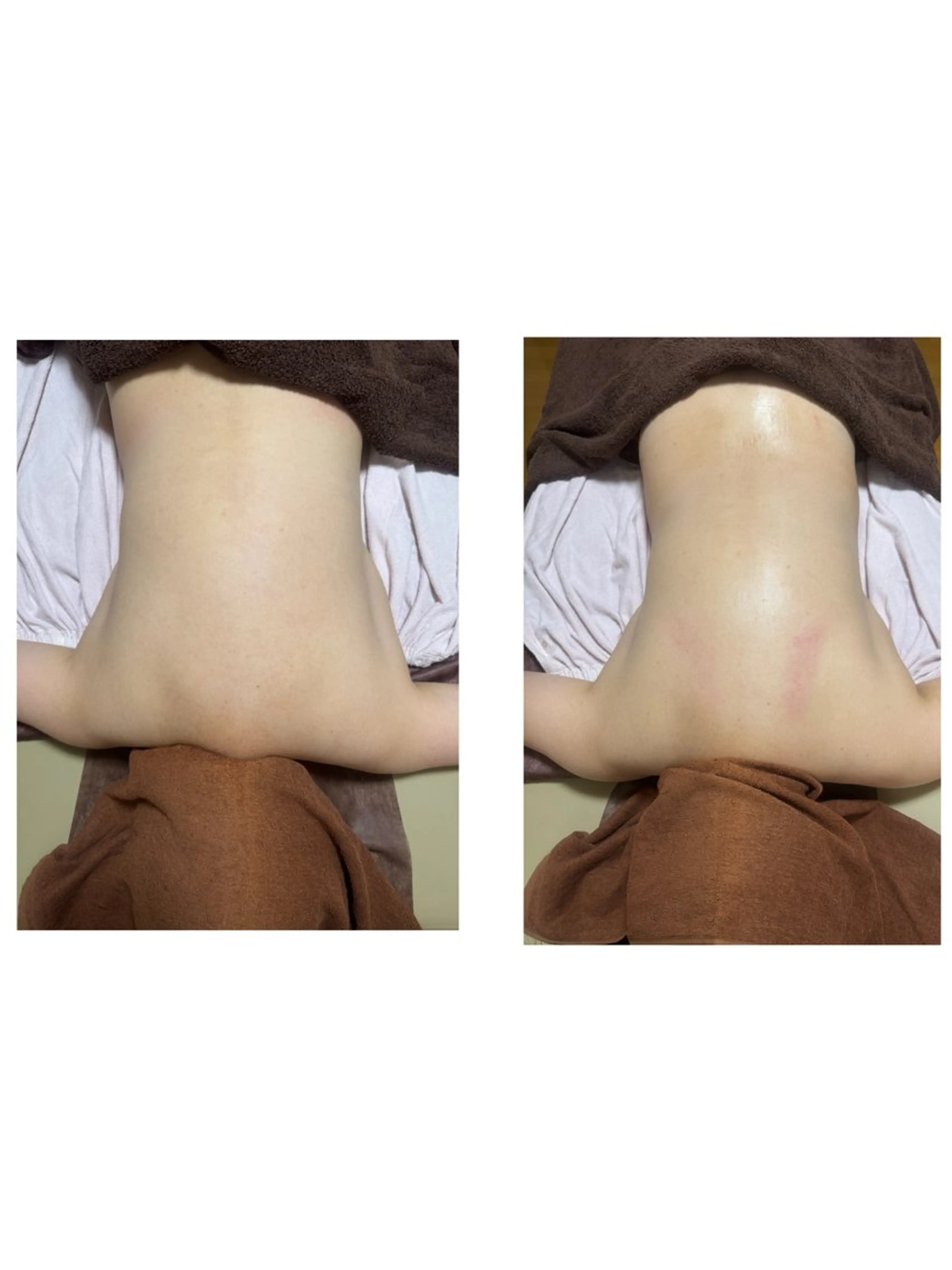 エステ リラク lymph kuppyのエステ・リラクイメージ