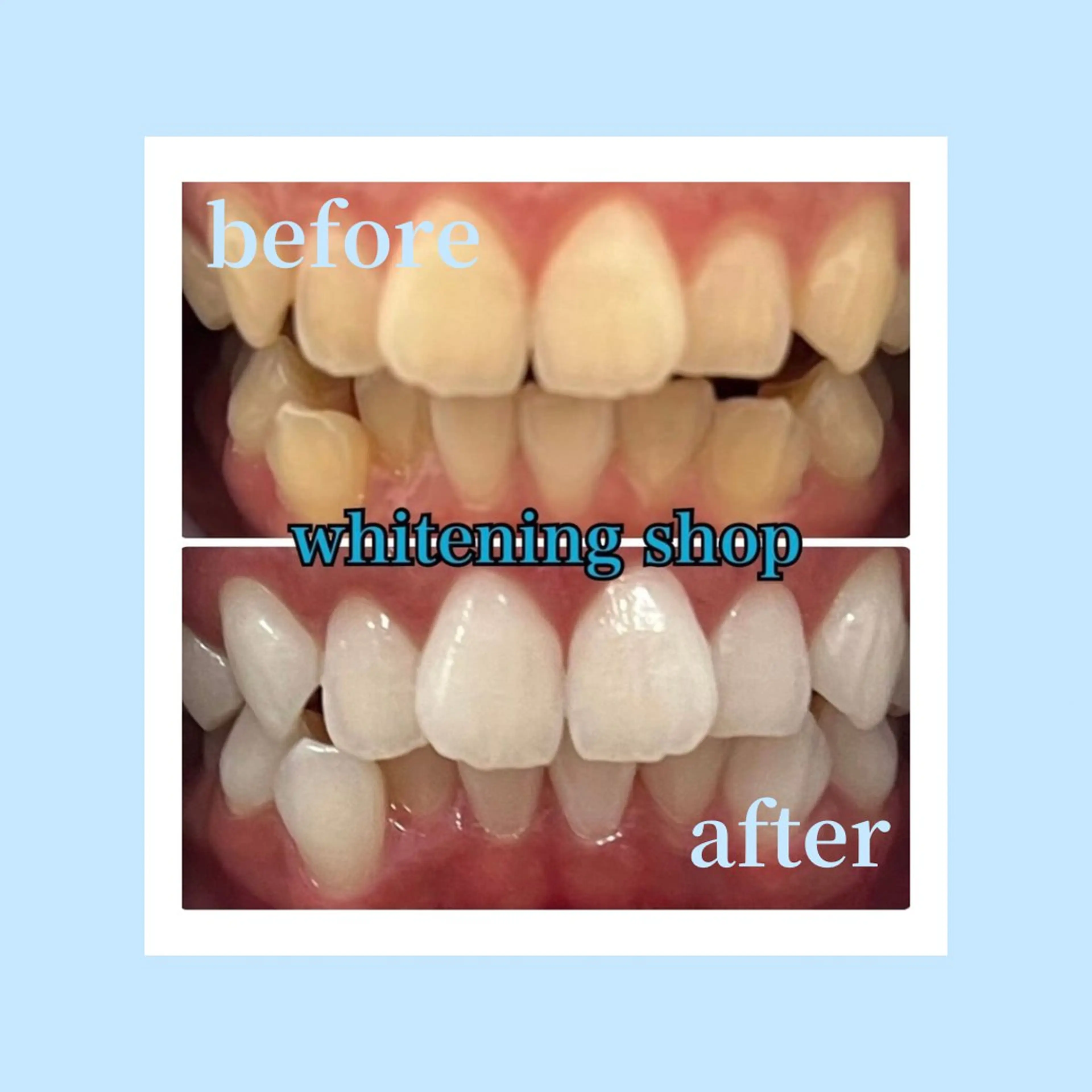 ホワイトニング ショップ光明池店のエステ・リラクイメージ