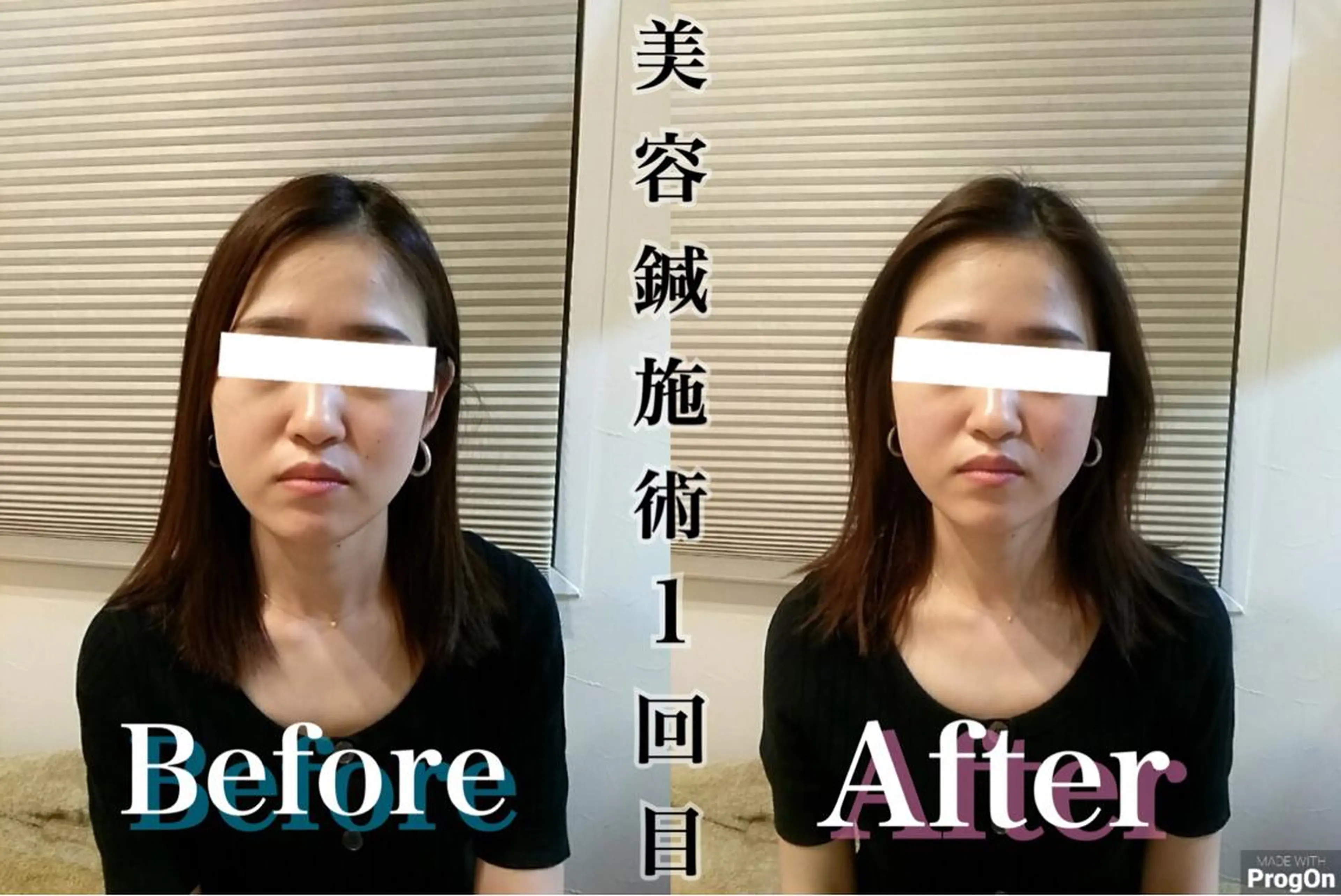 鍼灸 Refineのその他イメージ
