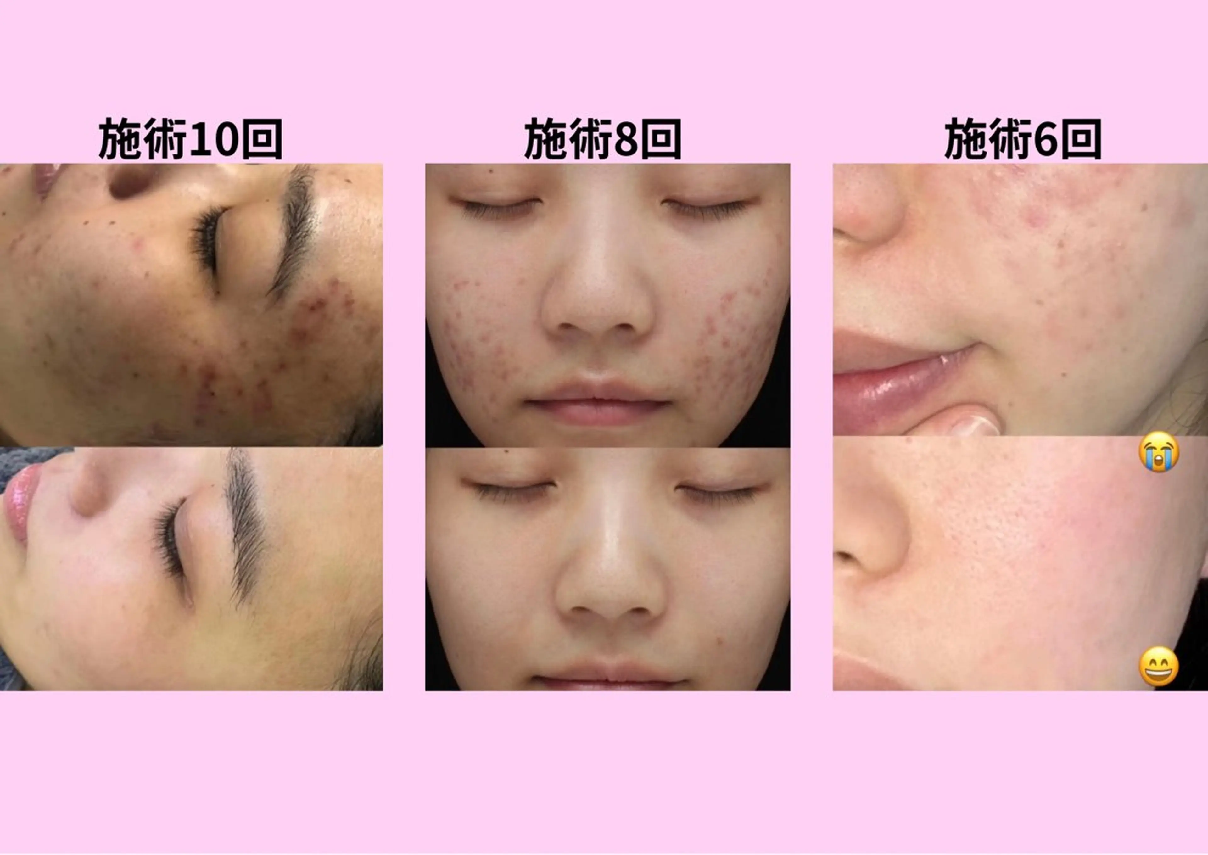 マツエク・マツパ エステ 愛維美水光美肌専門店 メンズレディースokのエステ・リラクイメージ