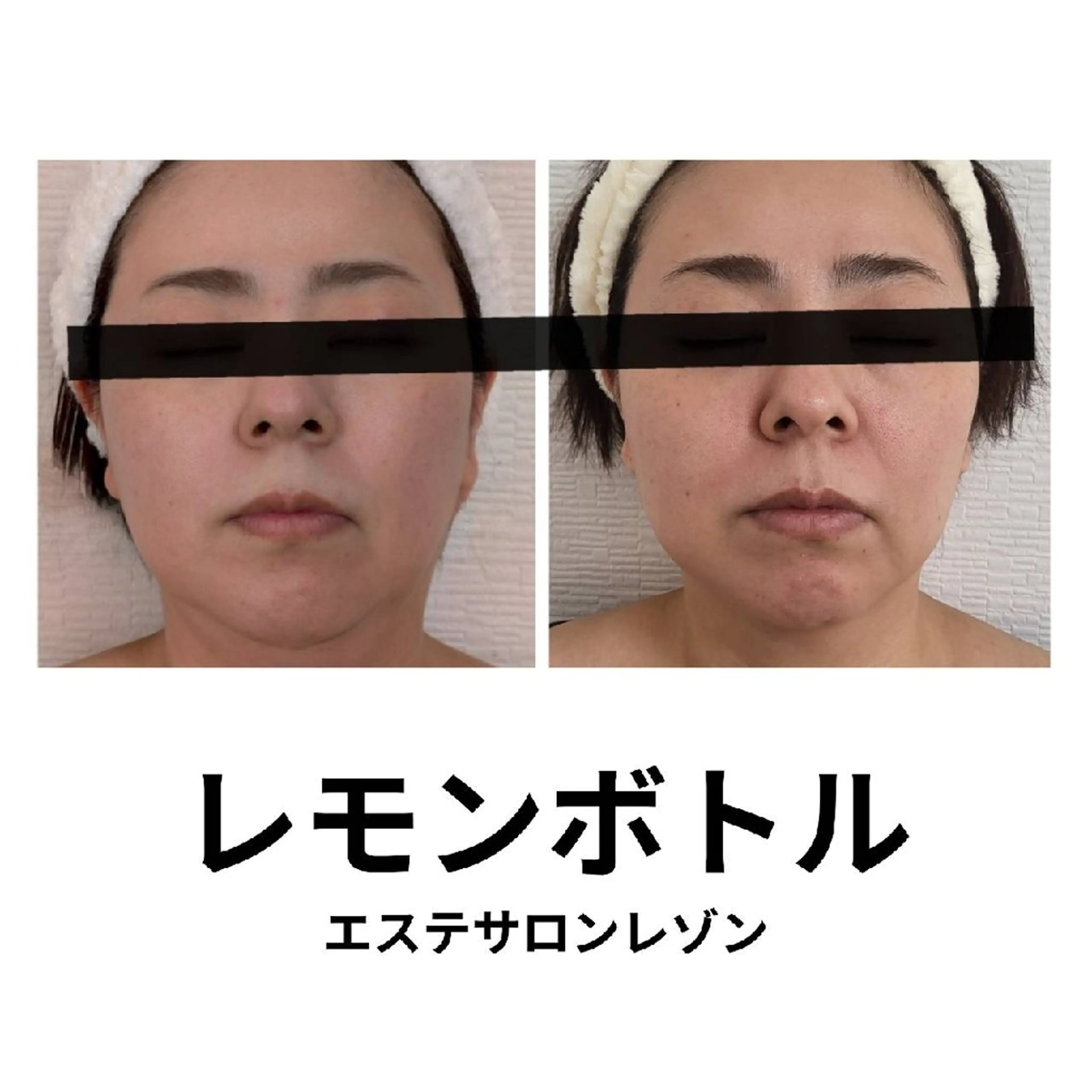 〈ニキビケアサロン〉 レゾン京橋店/ 浅川のエステ・リラクイメージ