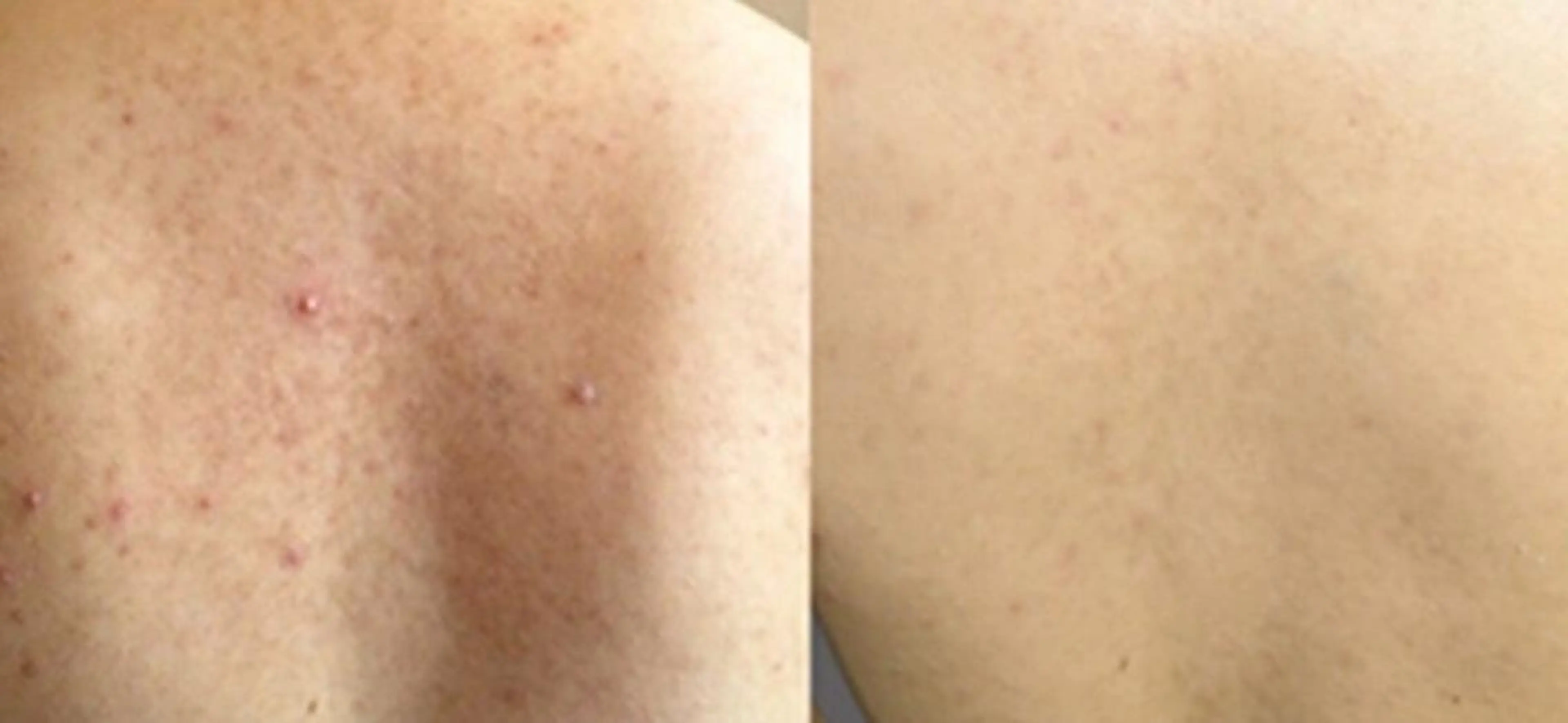 美容鍼灸サロンYOSHINO所属・美容鍼灸サロン YOSHINOのエステ・リラクイメージ