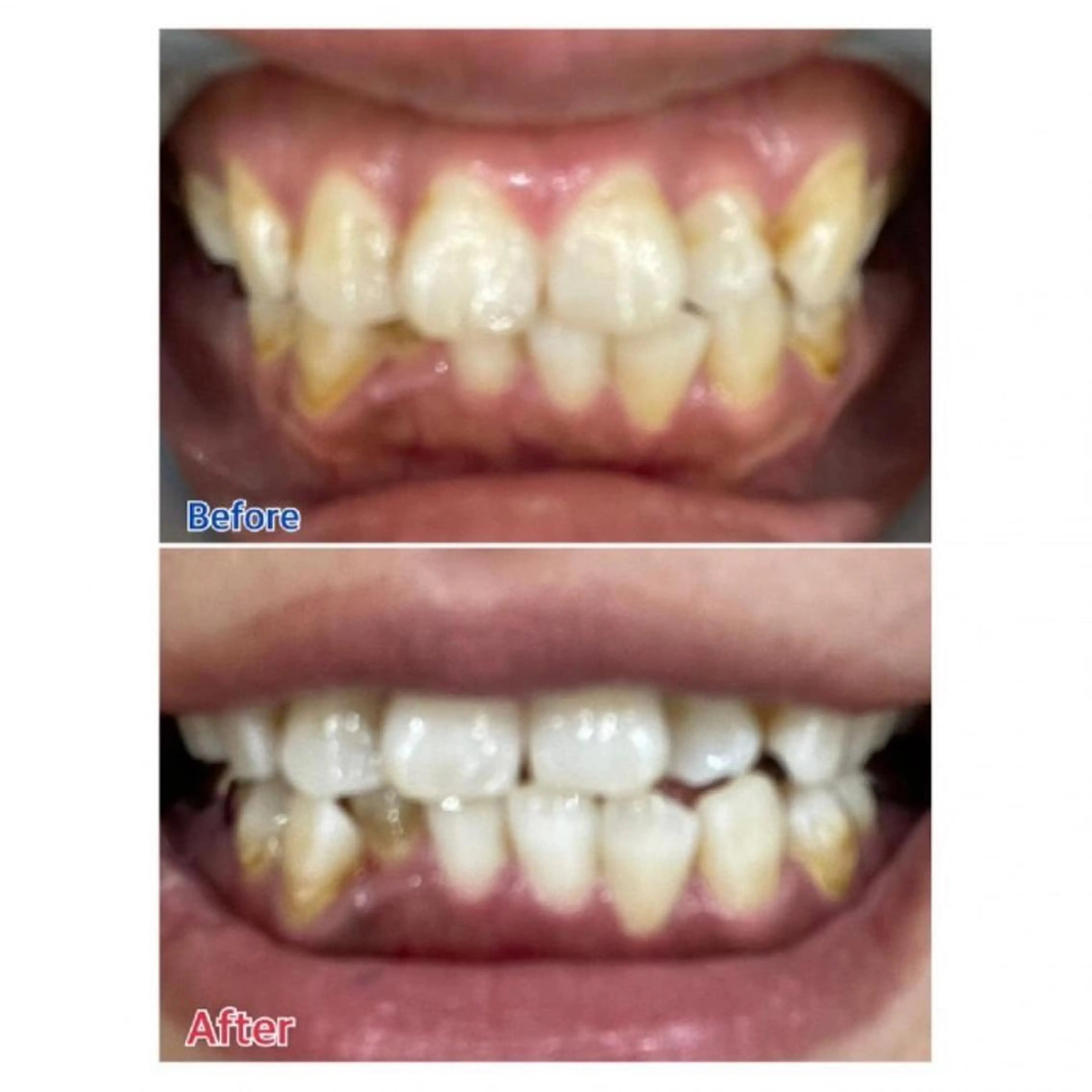 M渋谷 ホワイトニングのエステ・リラクイメージ