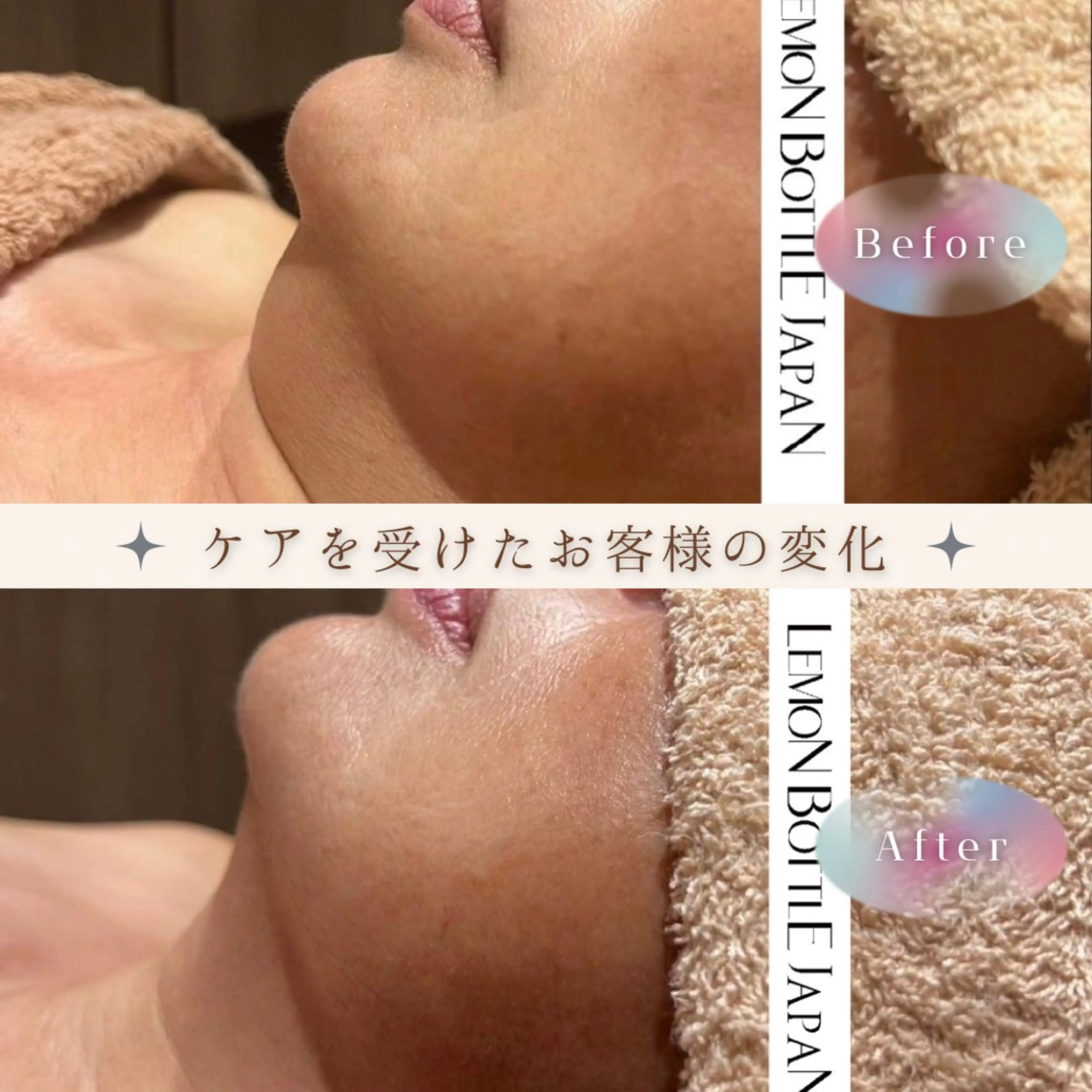 【🍋ボトル】韓国で話題🇰🇷リバウンドなし🌿脂肪細胞集中アプローチの写真