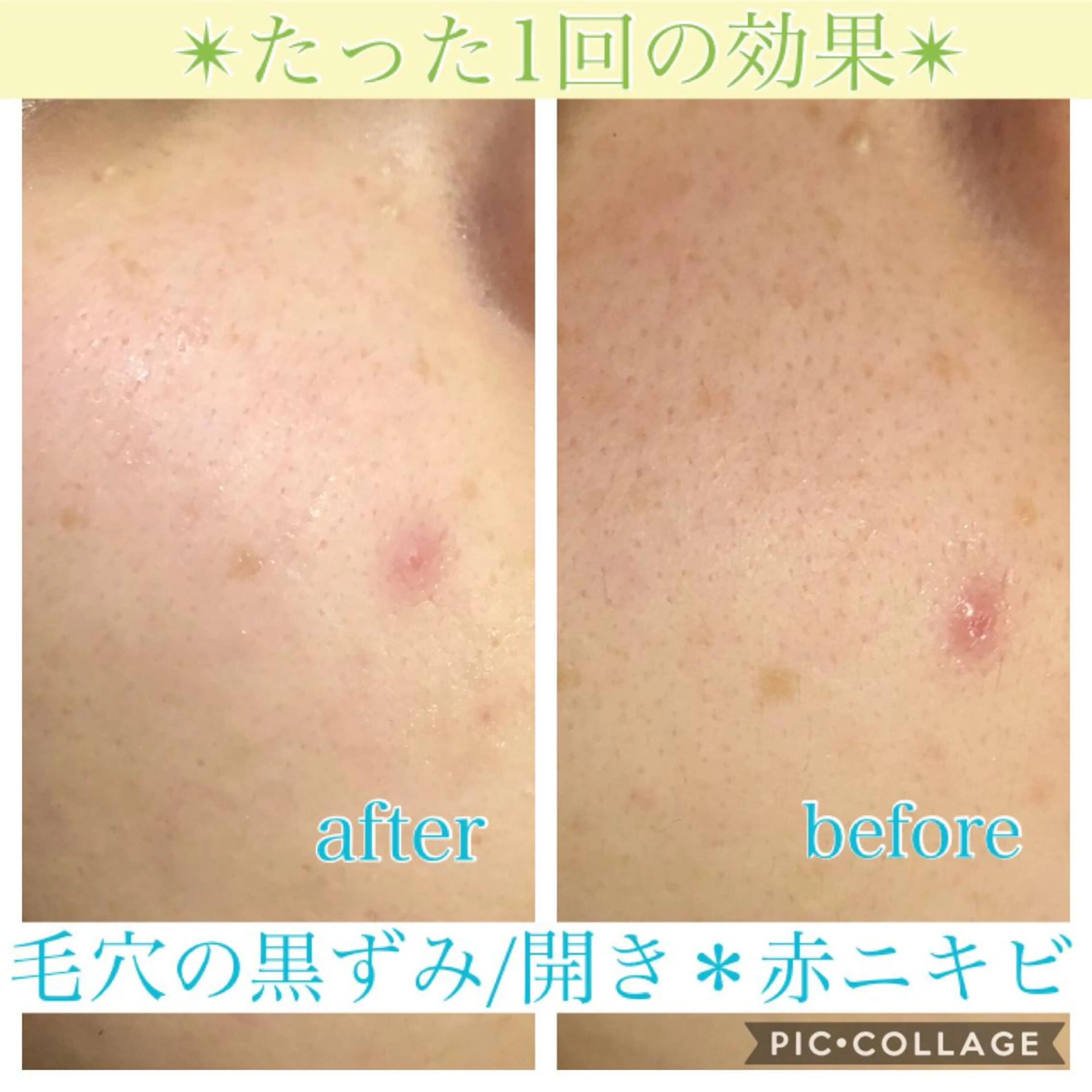 ロング カラー パーマ ヘアアレンジ メンズ キッズ ネイル マツエク・マツパ エステ リラク Ensor Clair所属・EnsorClair 代表 野口真央のエステ・リラクイメージ