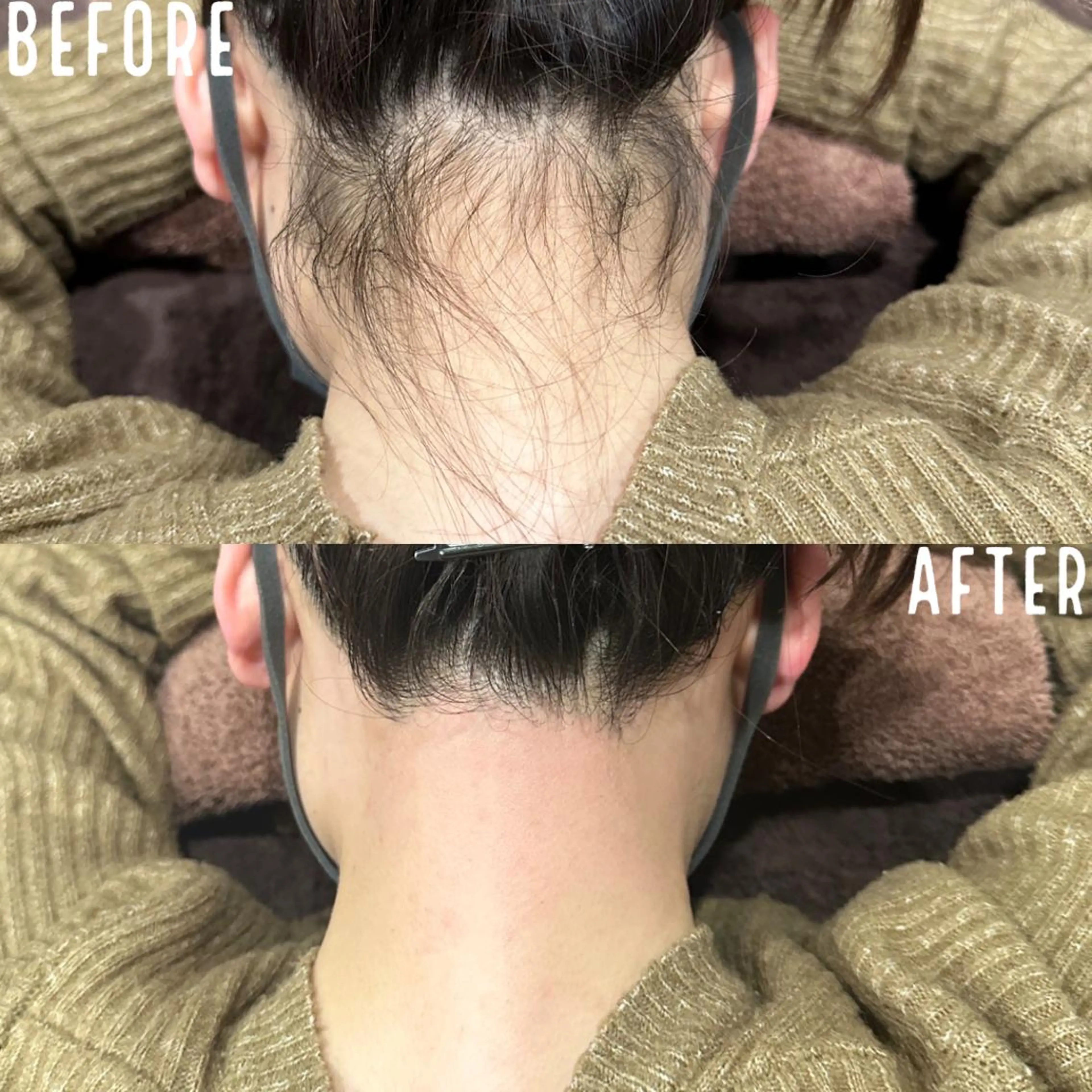 KOHOLA -ワックス脱毛専門-のエステ・リラクイメージ