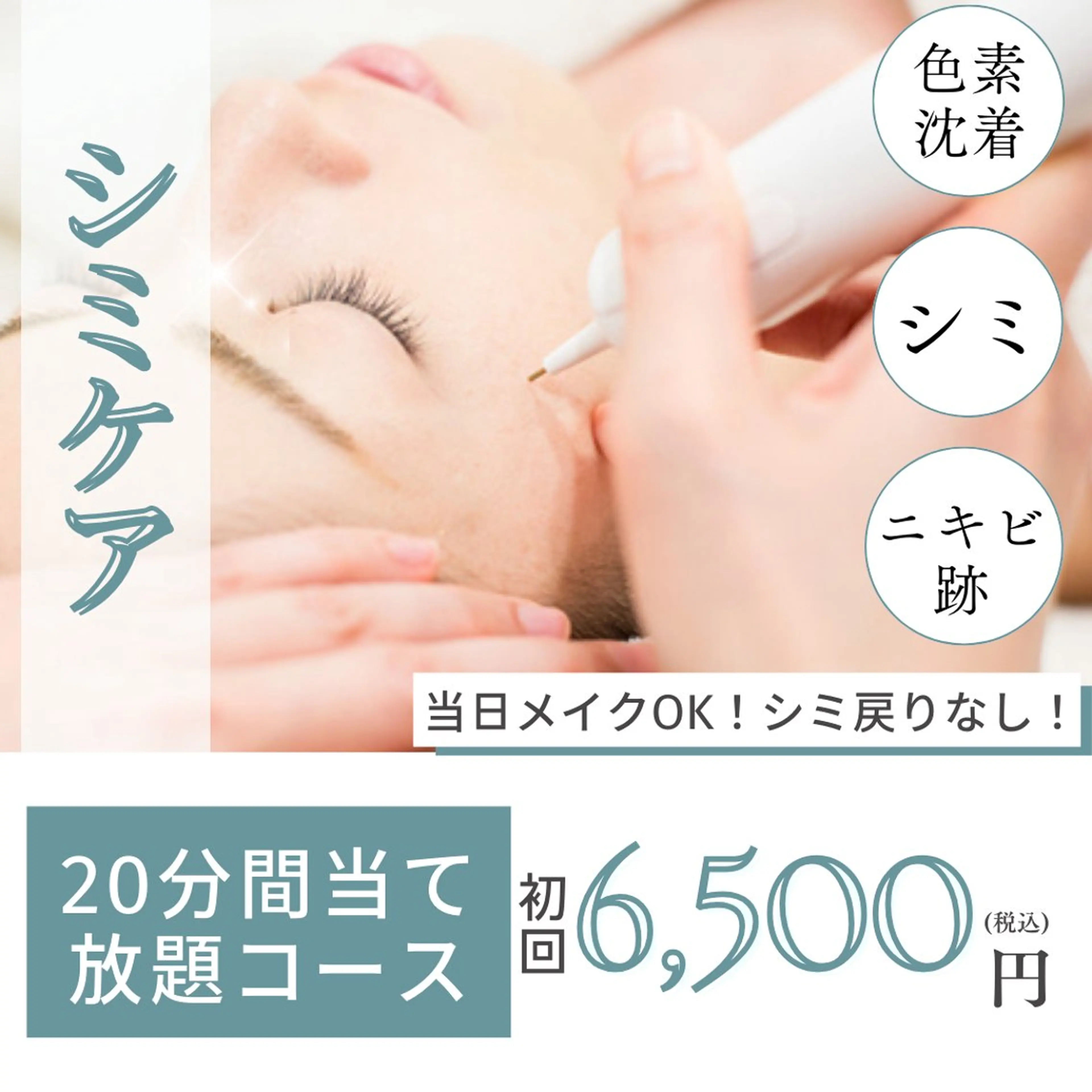 ✨シミ取り放題20分✨《シミケアコース》お肌に優しい低周波シミ取りで1週間で薄いシミも濃いシミもポロっと剥離◎の写真
