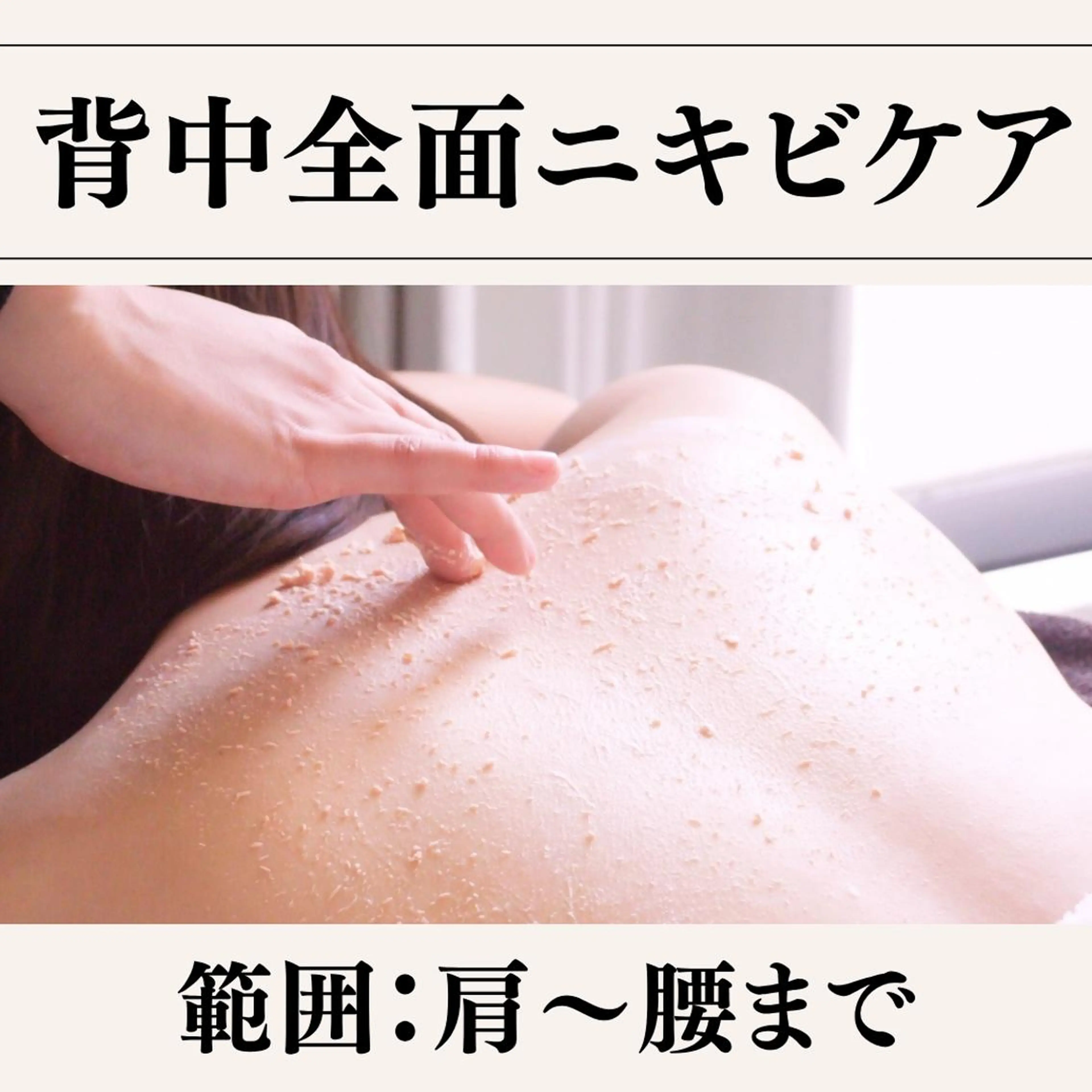 【背中全面のニキビ/ニキビ跡/毛穴ケアコース】好きな洋服が切れる背中に🍃180分・13,900円の写真