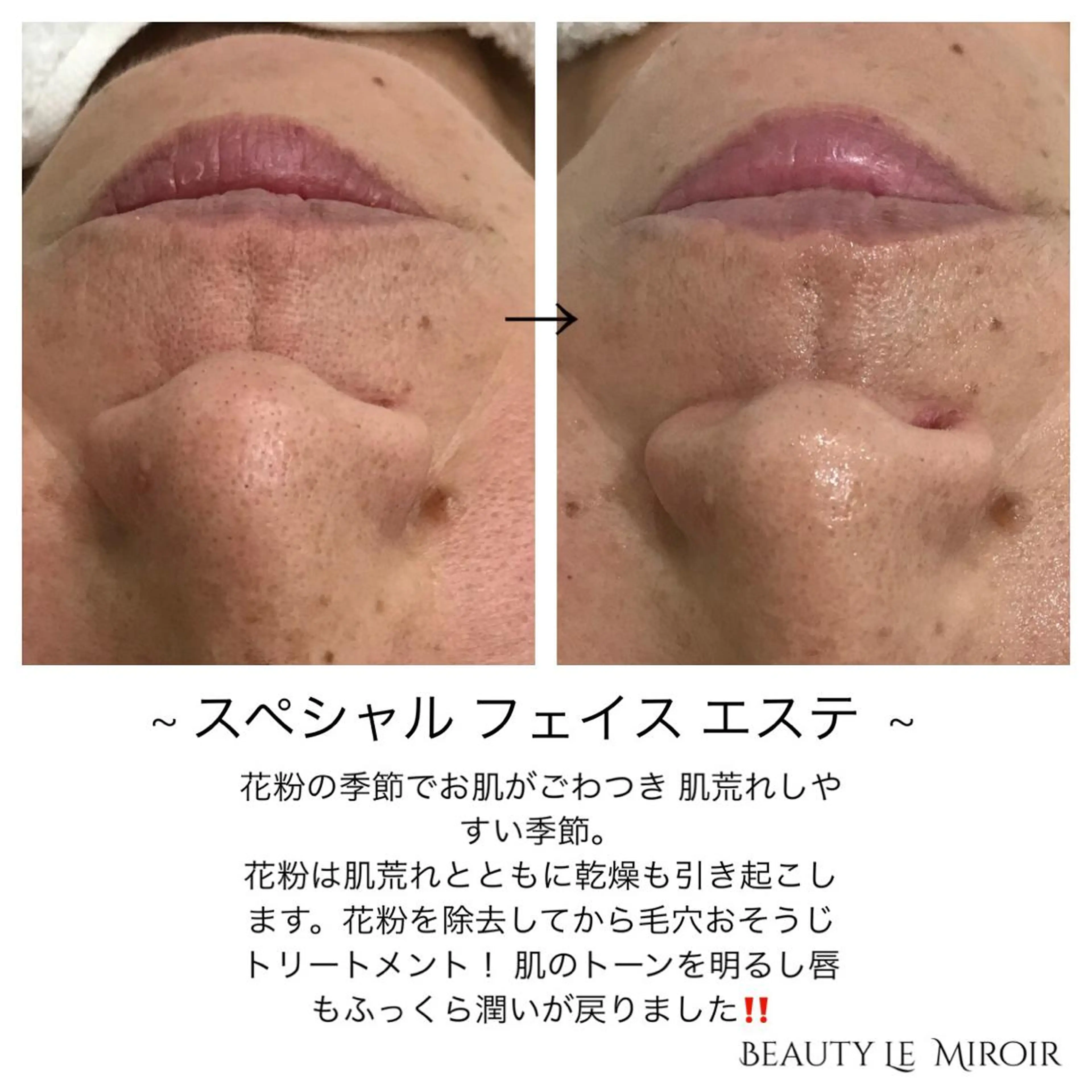 ビューティー ミロワールのエステ・リラクイメージ