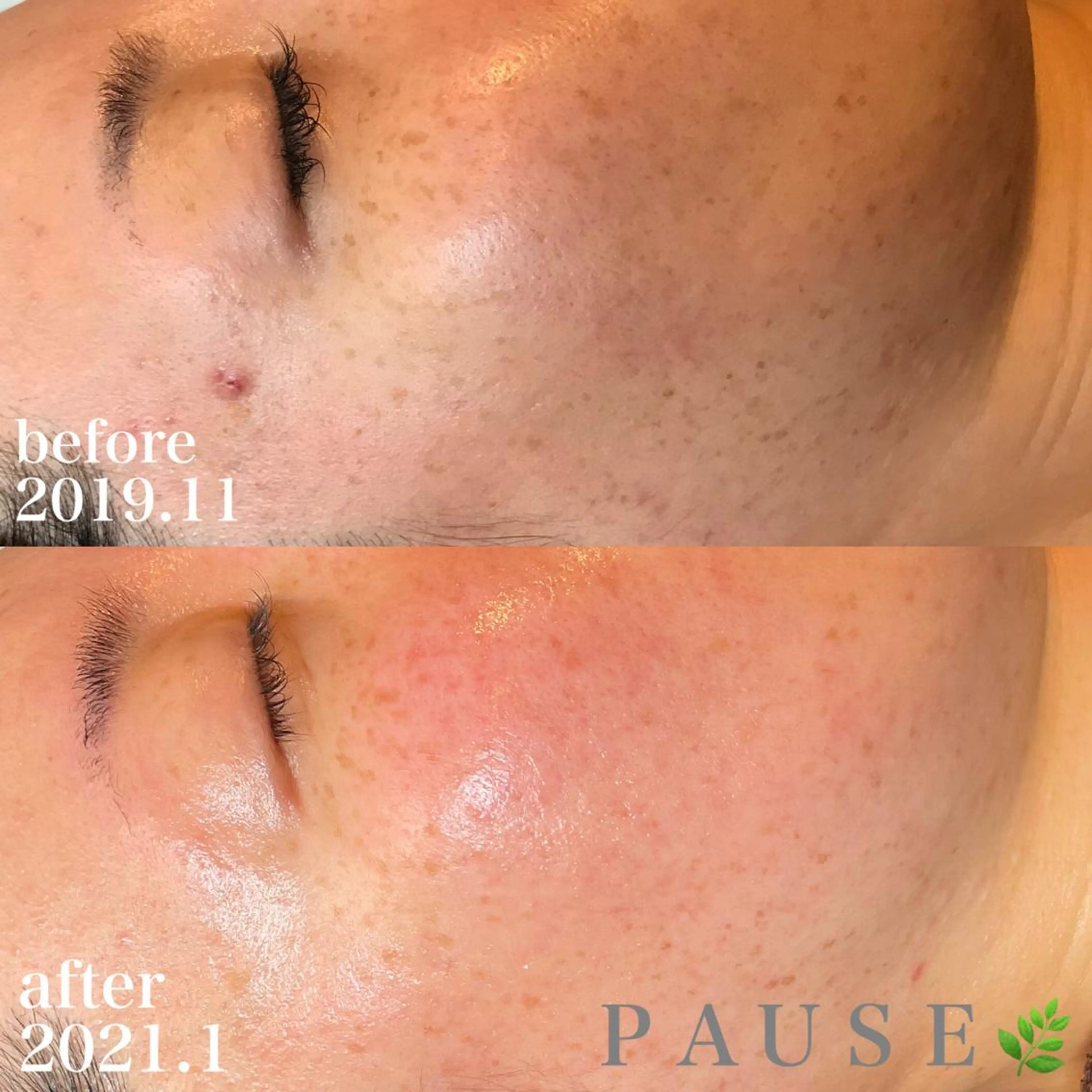 エステ 浜野 恵美のエステ・リラクイメージ