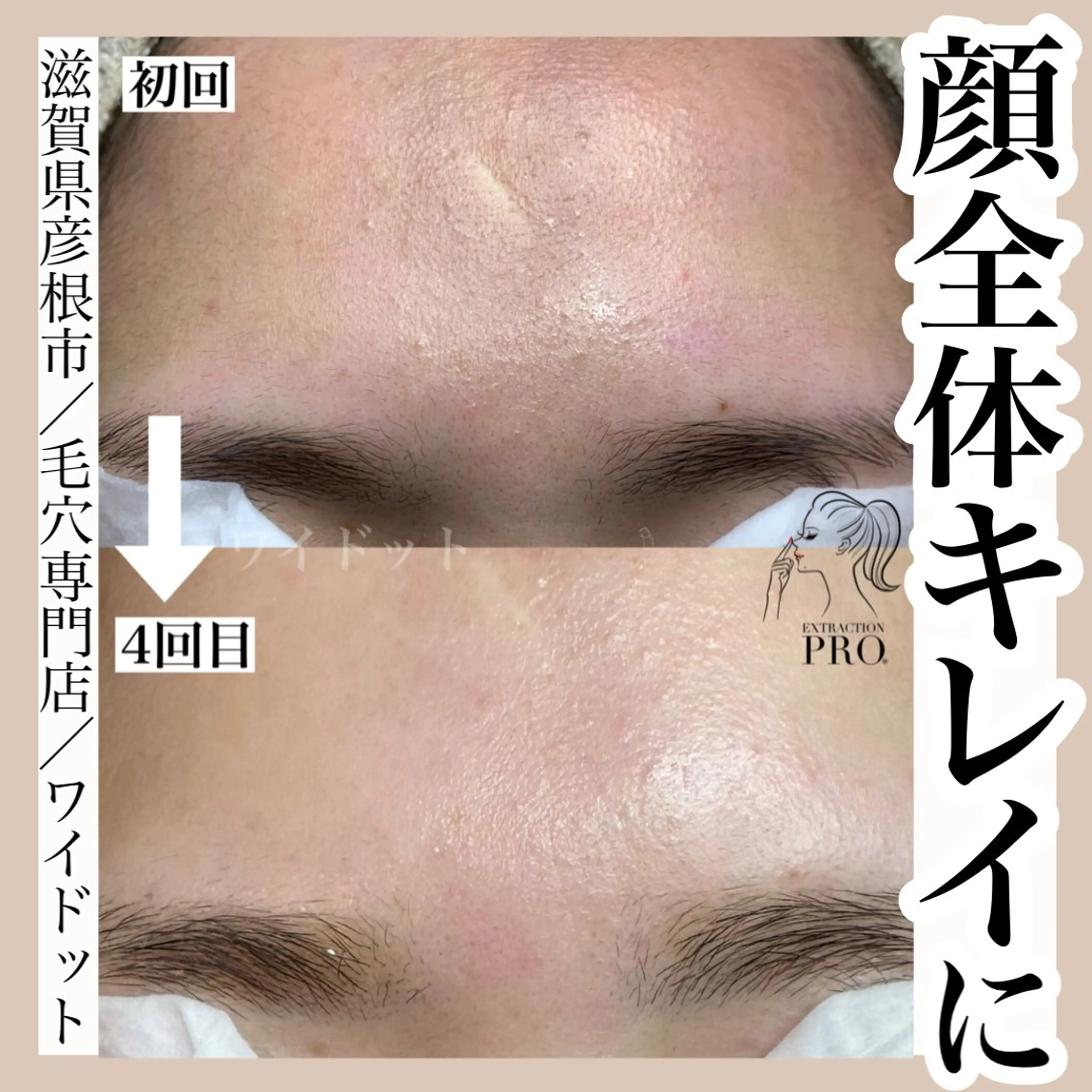 エステ Ydot. 池内 友架のエステ・リラクイメージ