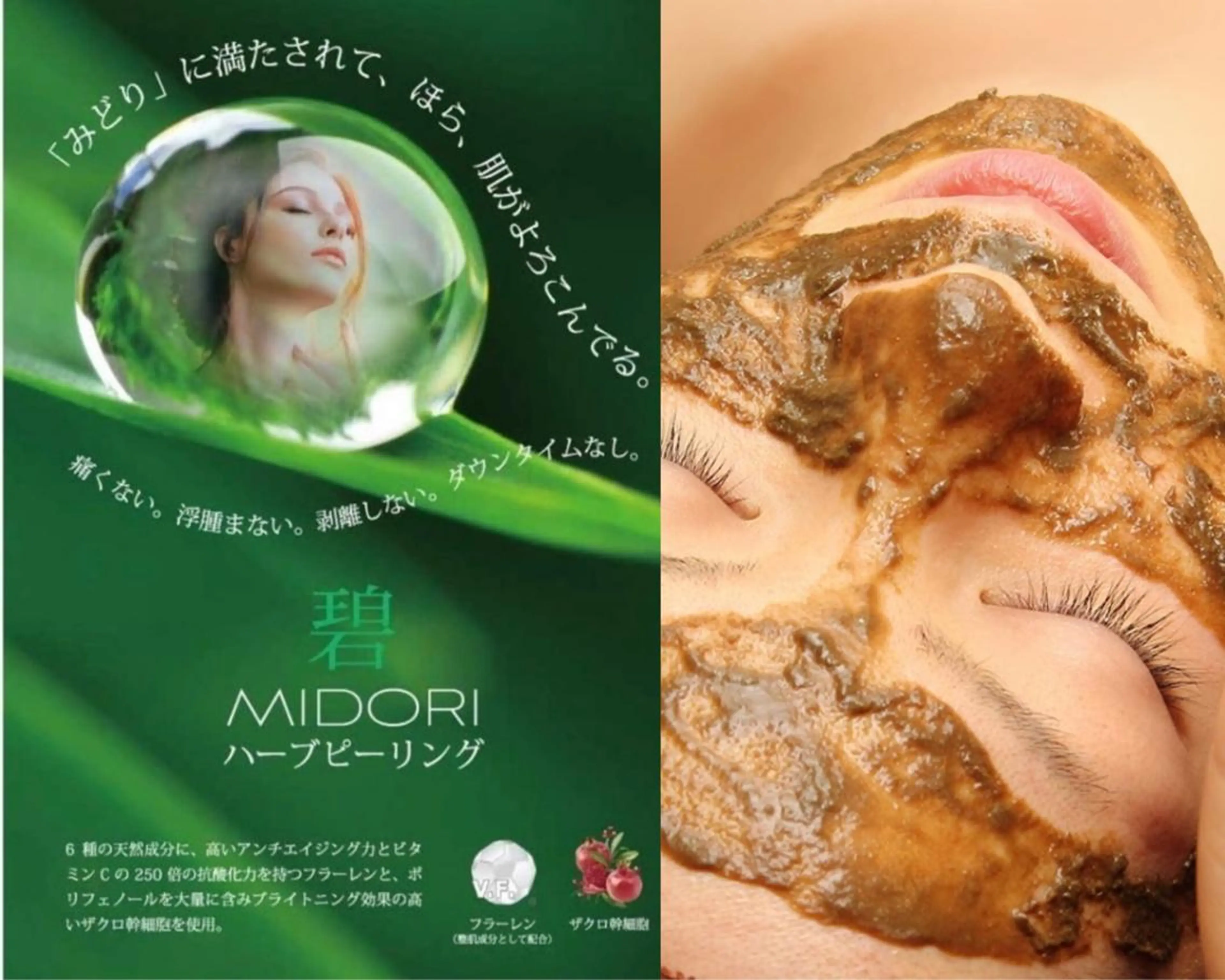 💛 肌質改善💛🌿日本製ハーブピーリング🌿DTなし!どんなお肌にも🆗日本製ハーブピーリング🌿の写真