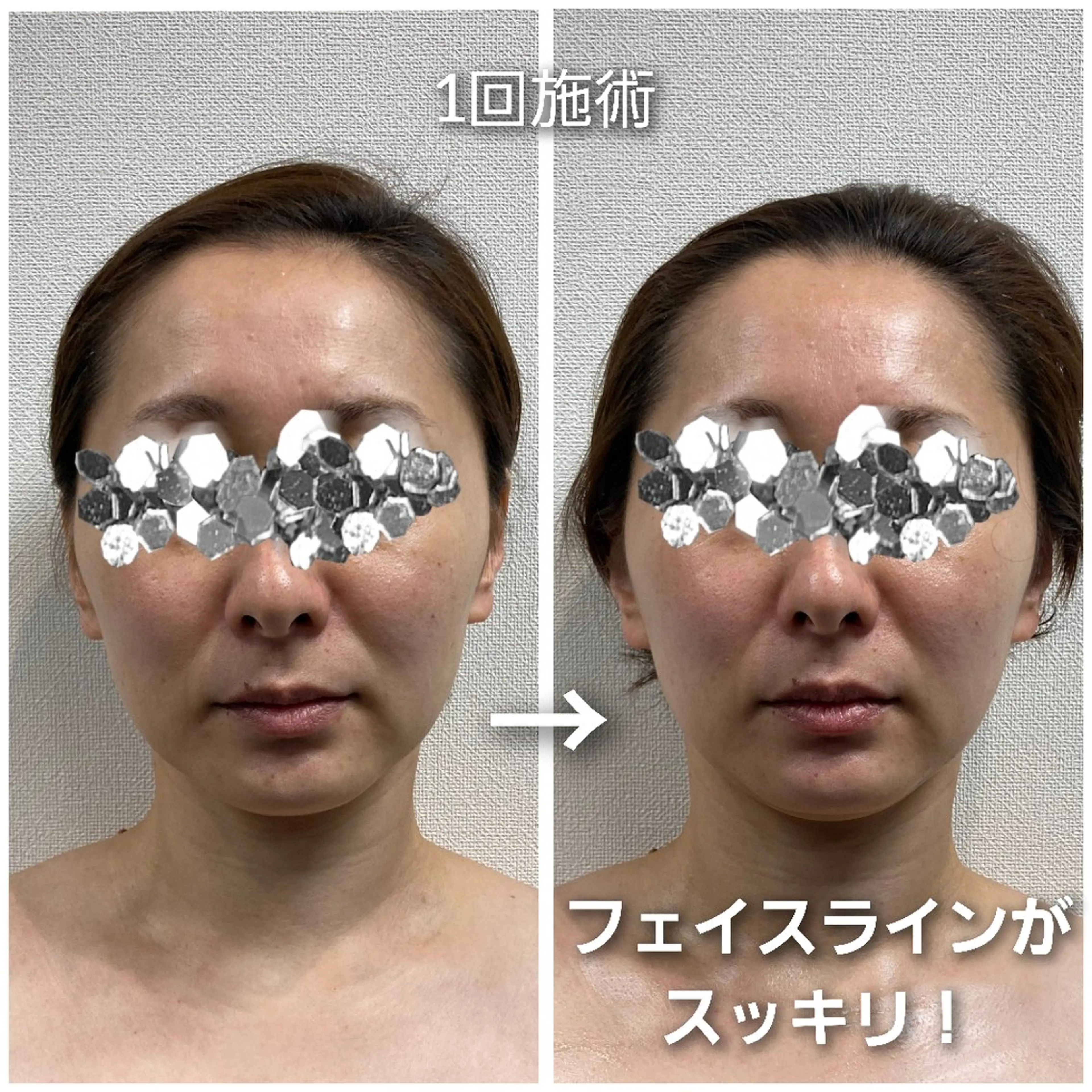 シミ・たるみ専門 サロン Cherieのエステ・リラクイメージ