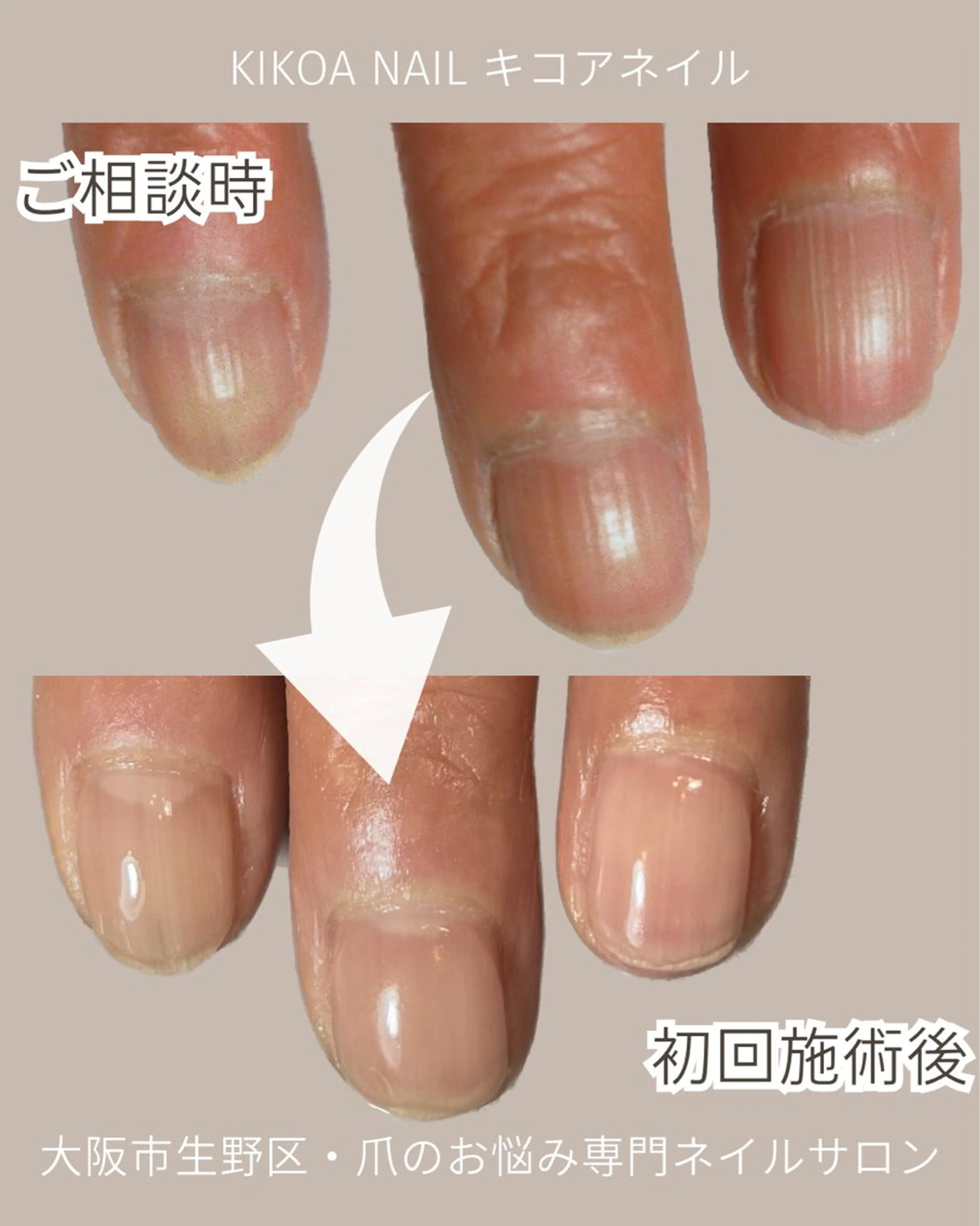 ネイル メンズネイル KIKOA NAIL キコアネイルのネイルデザイン