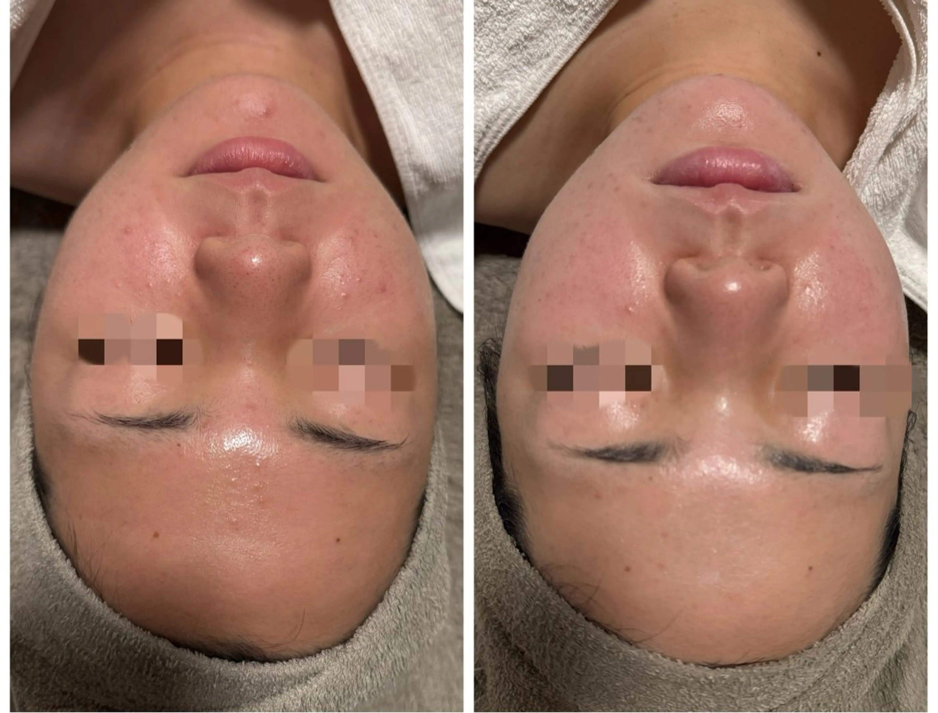 エステ リラク lumirise所属・lumi riseのエステ・リラクイメージ