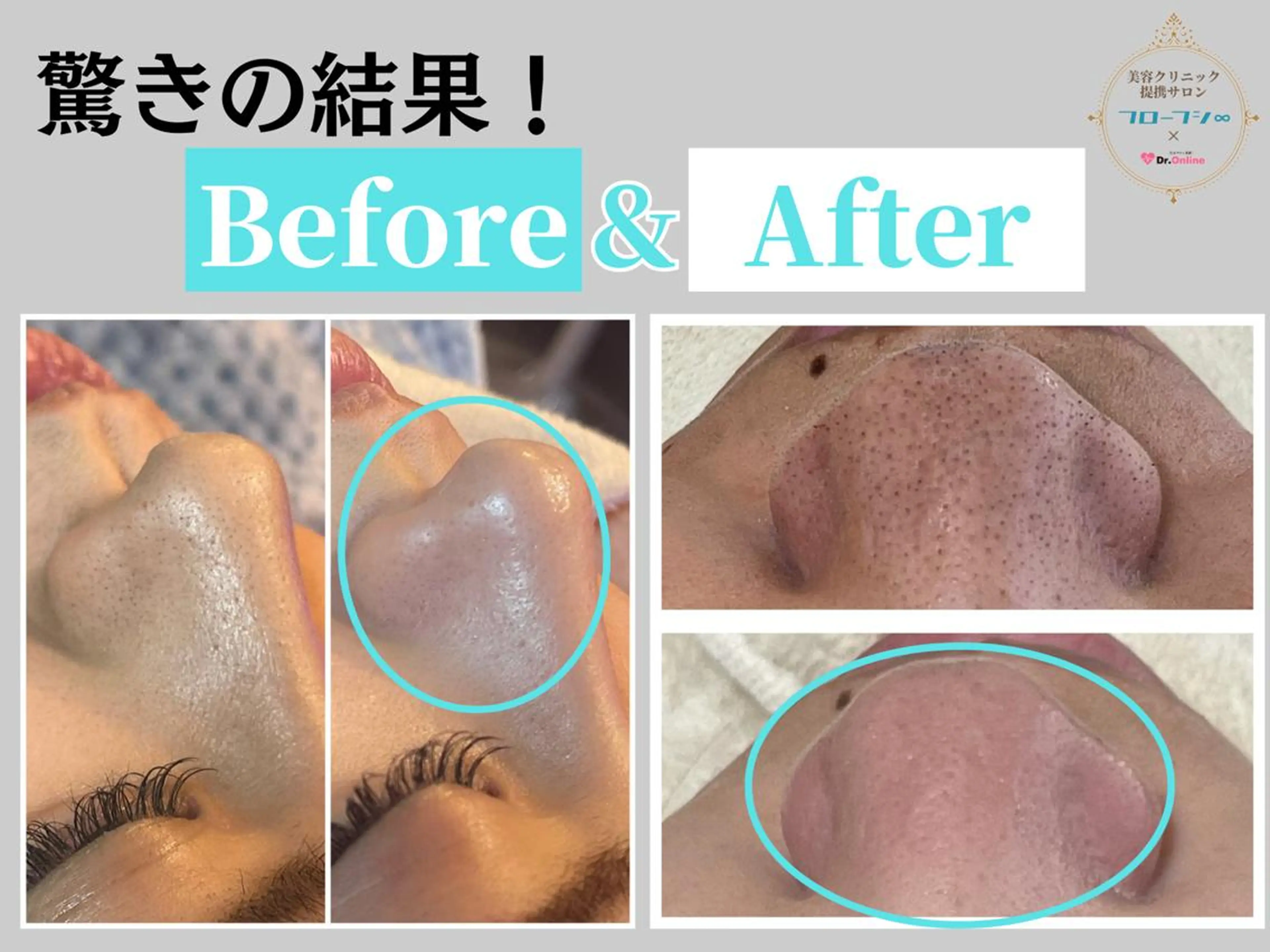 部分痩せ♥️小顔専門 MIKUのエステ・リラクイメージ