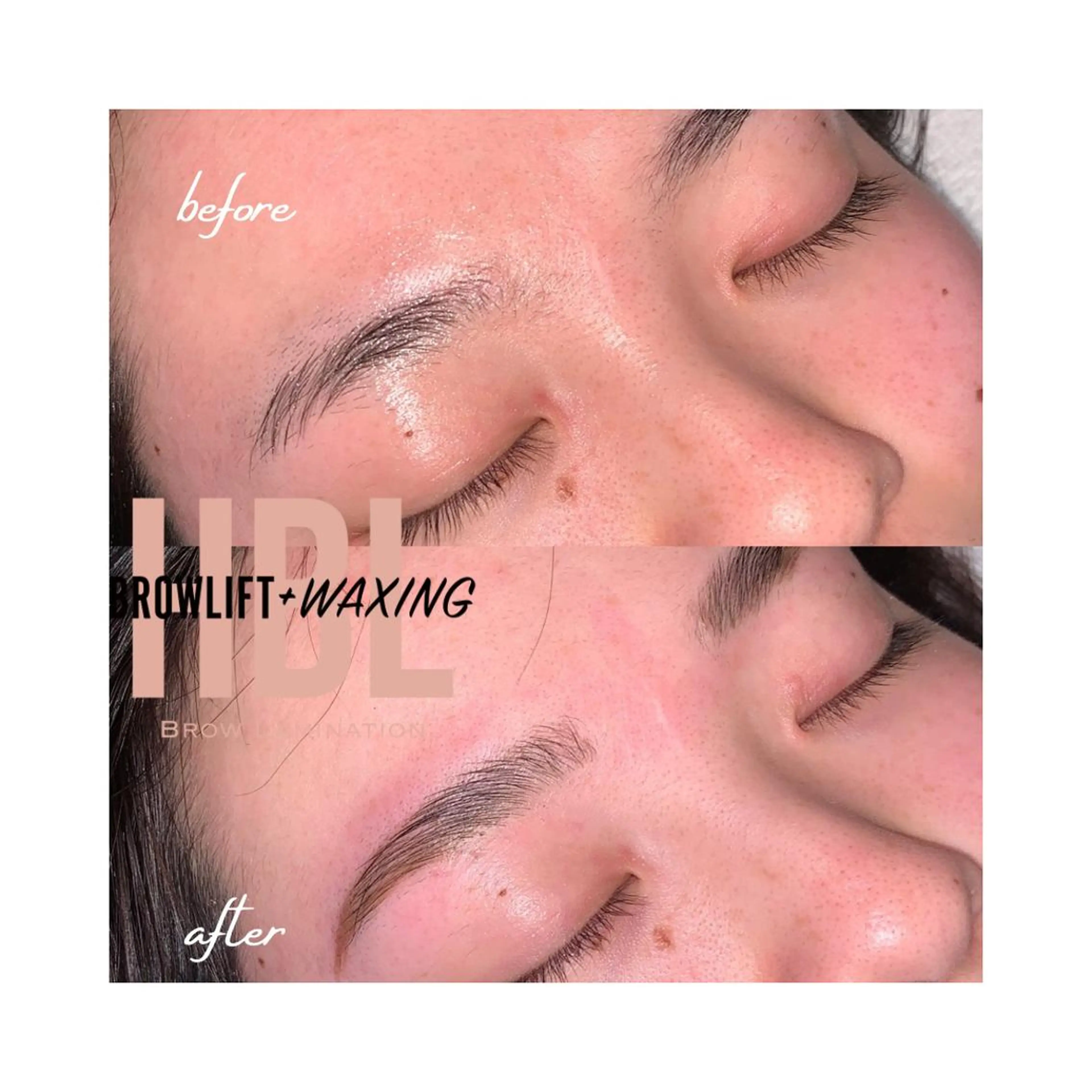 アイブロウ ハリウッドブロウリフト 眉毛ワックス脱毛 ワックス脱毛 その他(アイブロウ) 松下 睦美のエステ・リラクイメージ