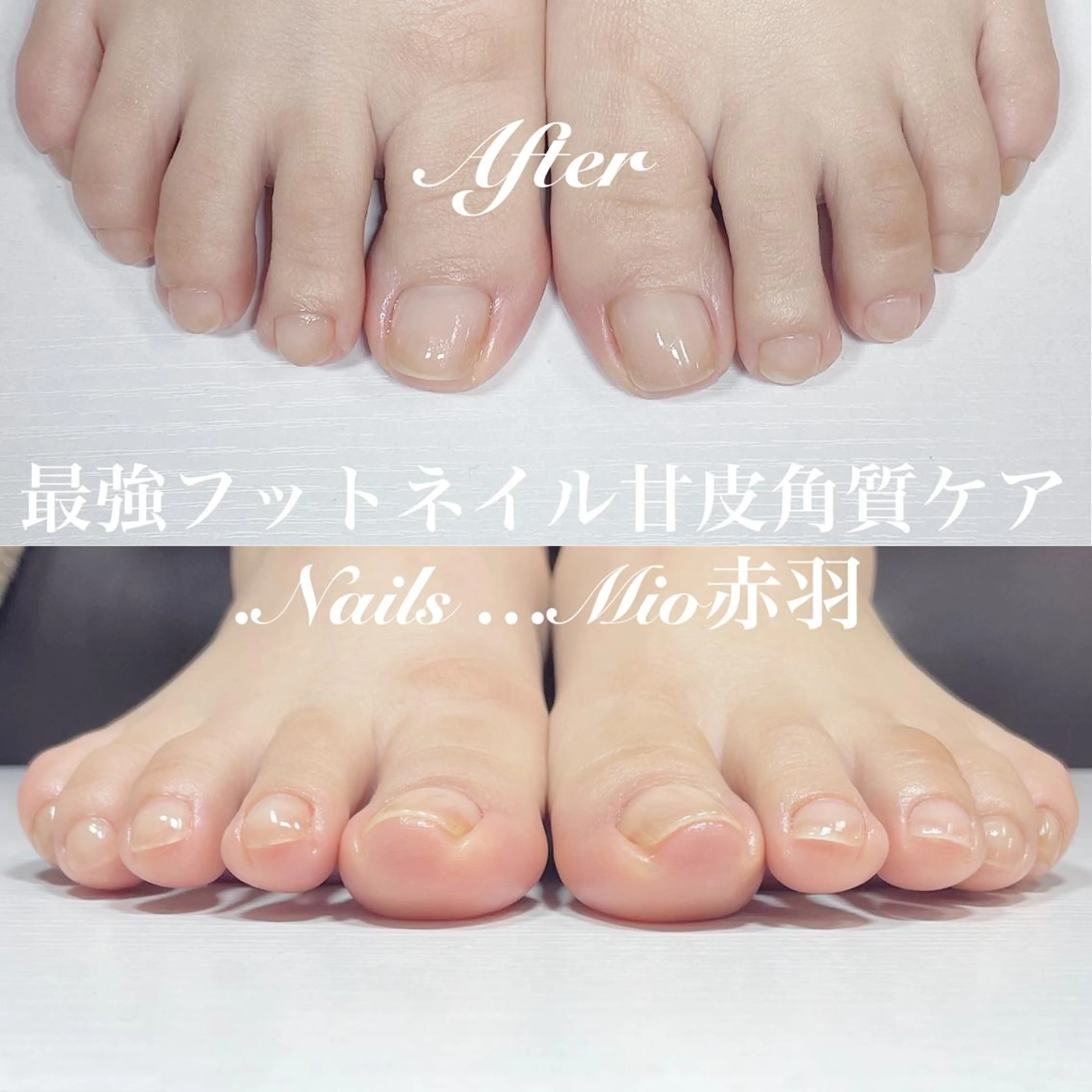 ネイル フットネイル フットネイル .Nails Mio 赤羽西ネイルサロンのネイルデザイン