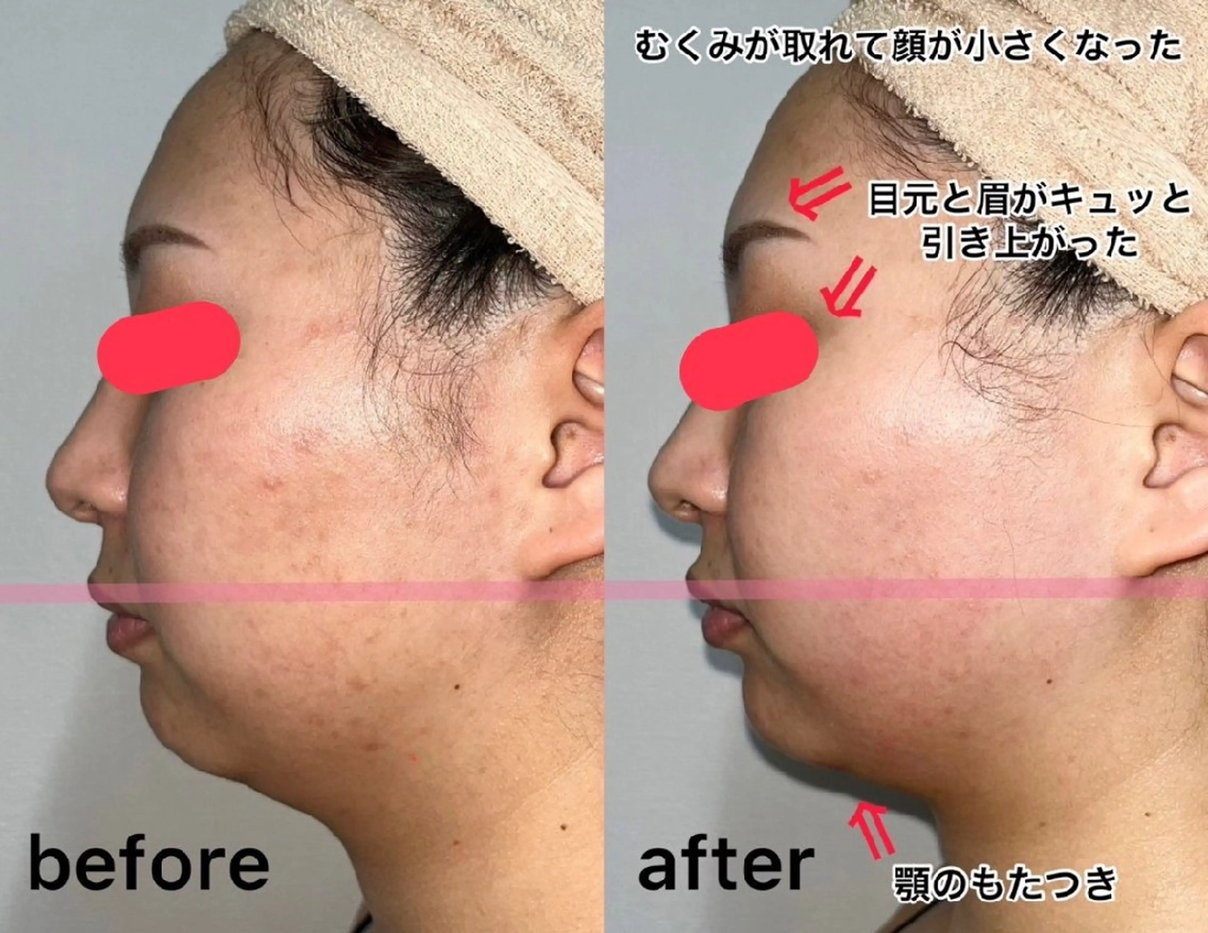 メンズ エステ salonde ReGodのエステ・リラクイメージ