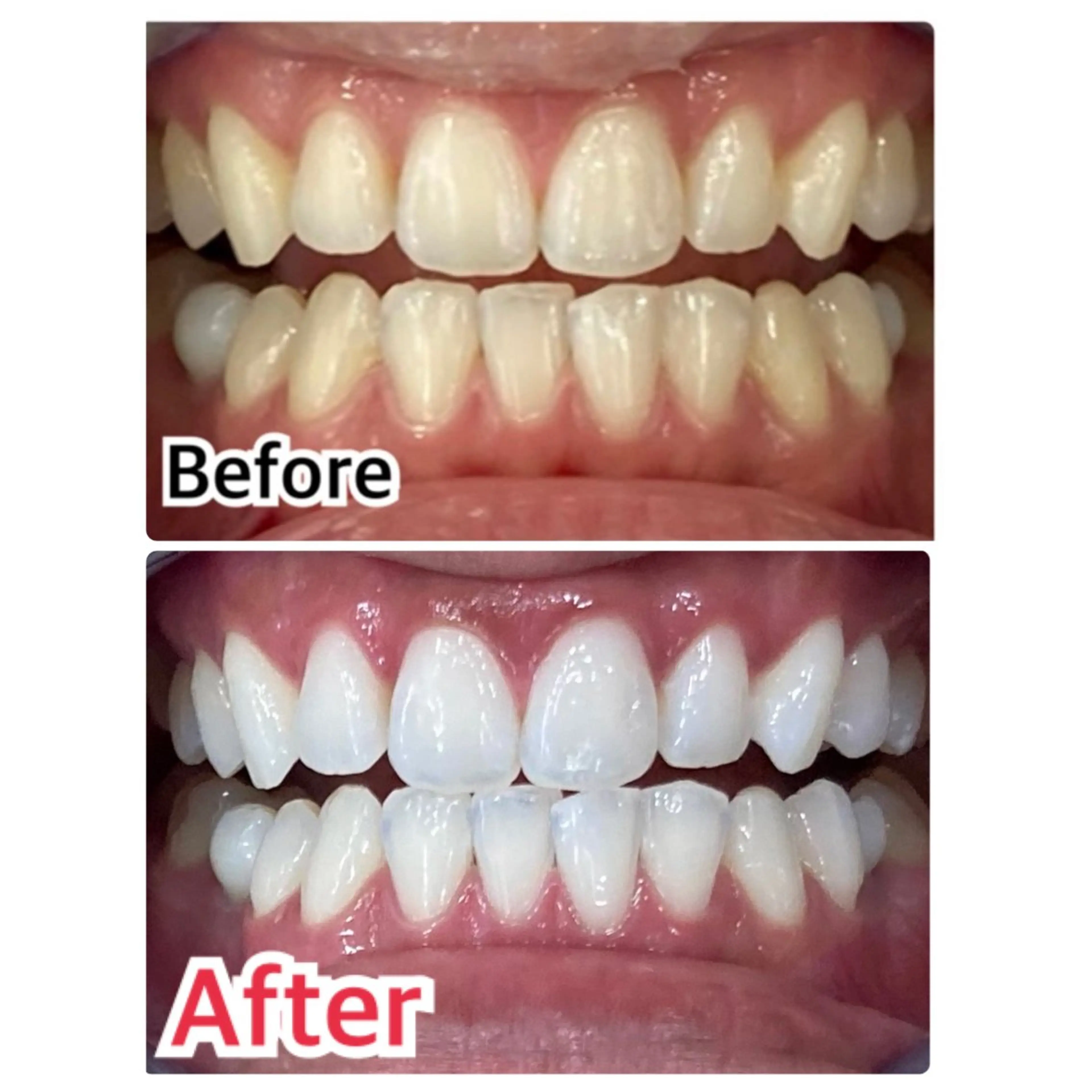 プラチナムビューティー柏所属・【歯科提携】柏ホワイ トニングスタイルのその他イメージ