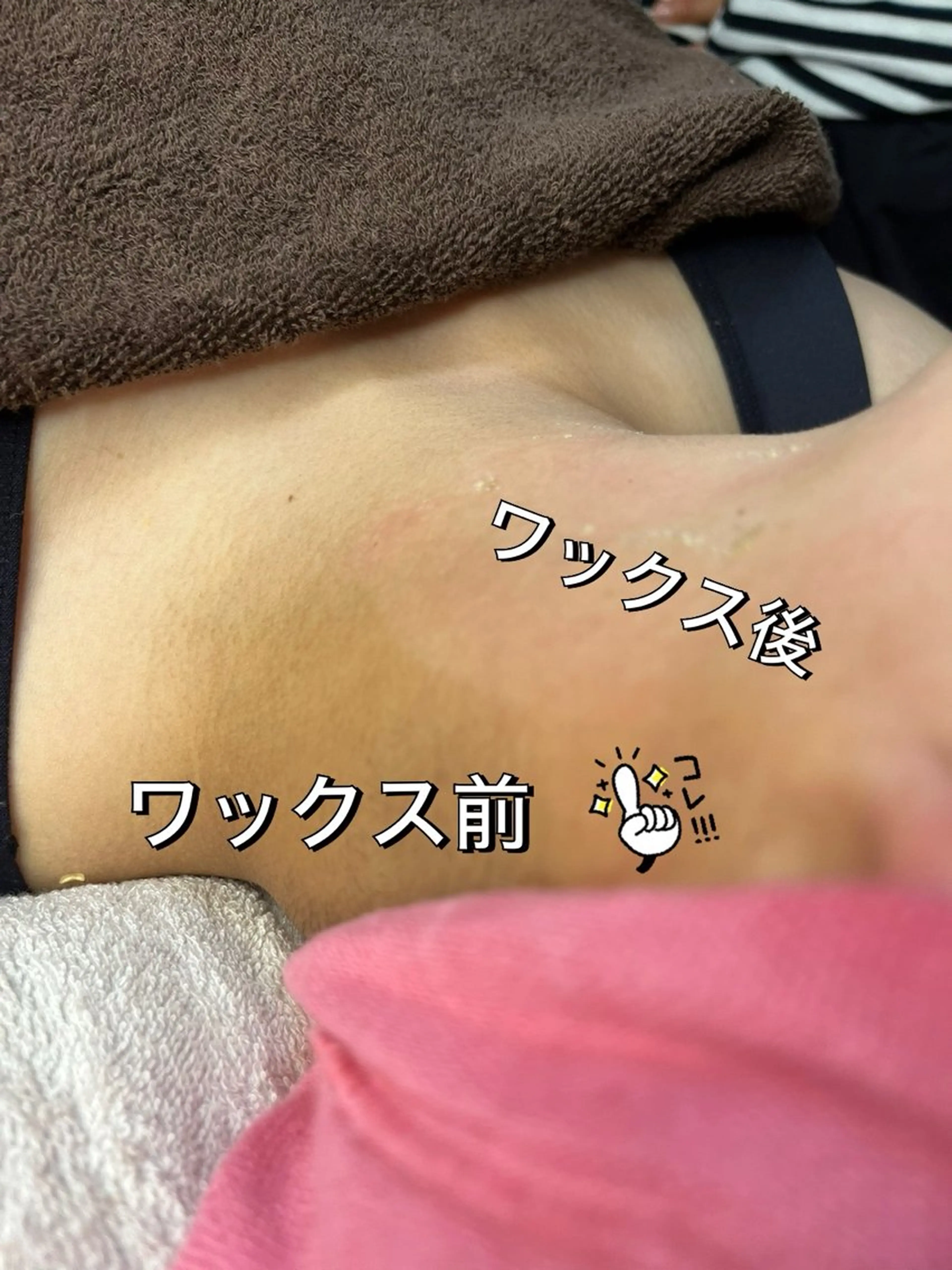 脱毛 【光＆WAX脱毛】セラヴィプライベートサロン（メンズ・キッズも可）所属・kaise makiのエステ・リラクイメージ