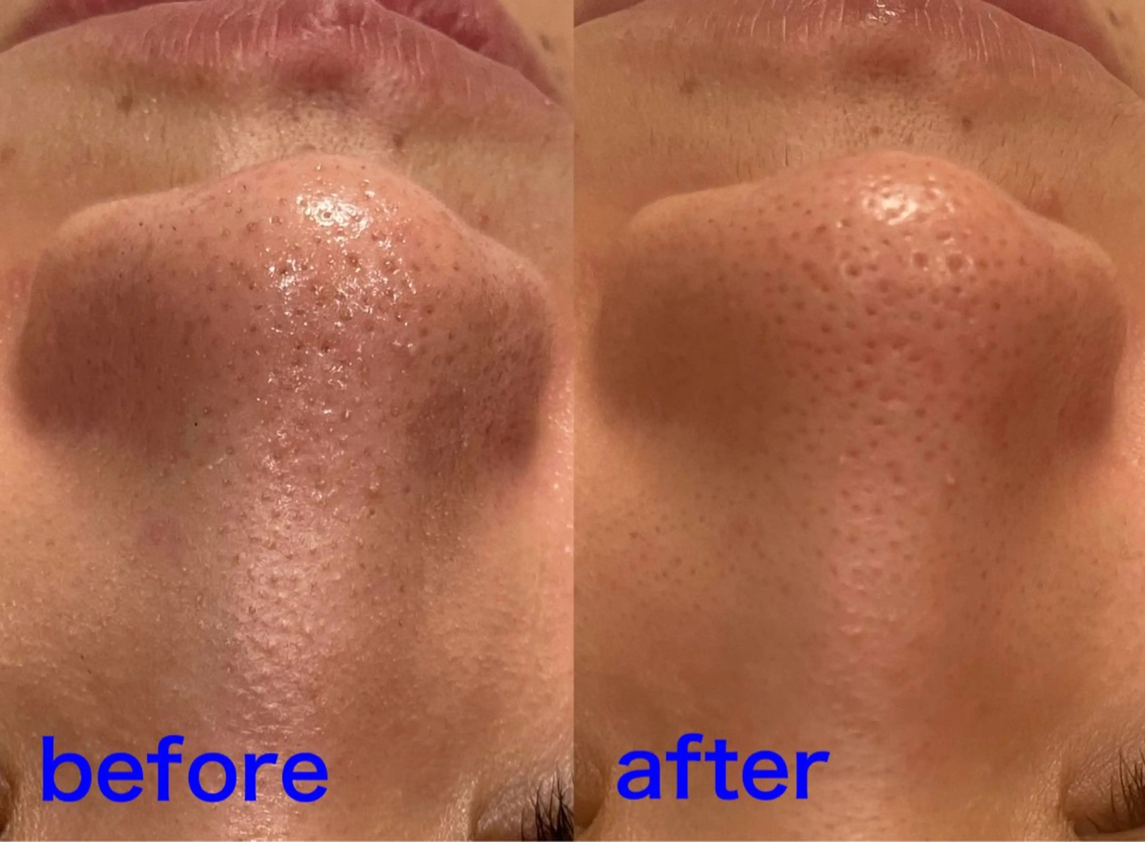 エステ Fulala 永田のエステ・リラクイメージ