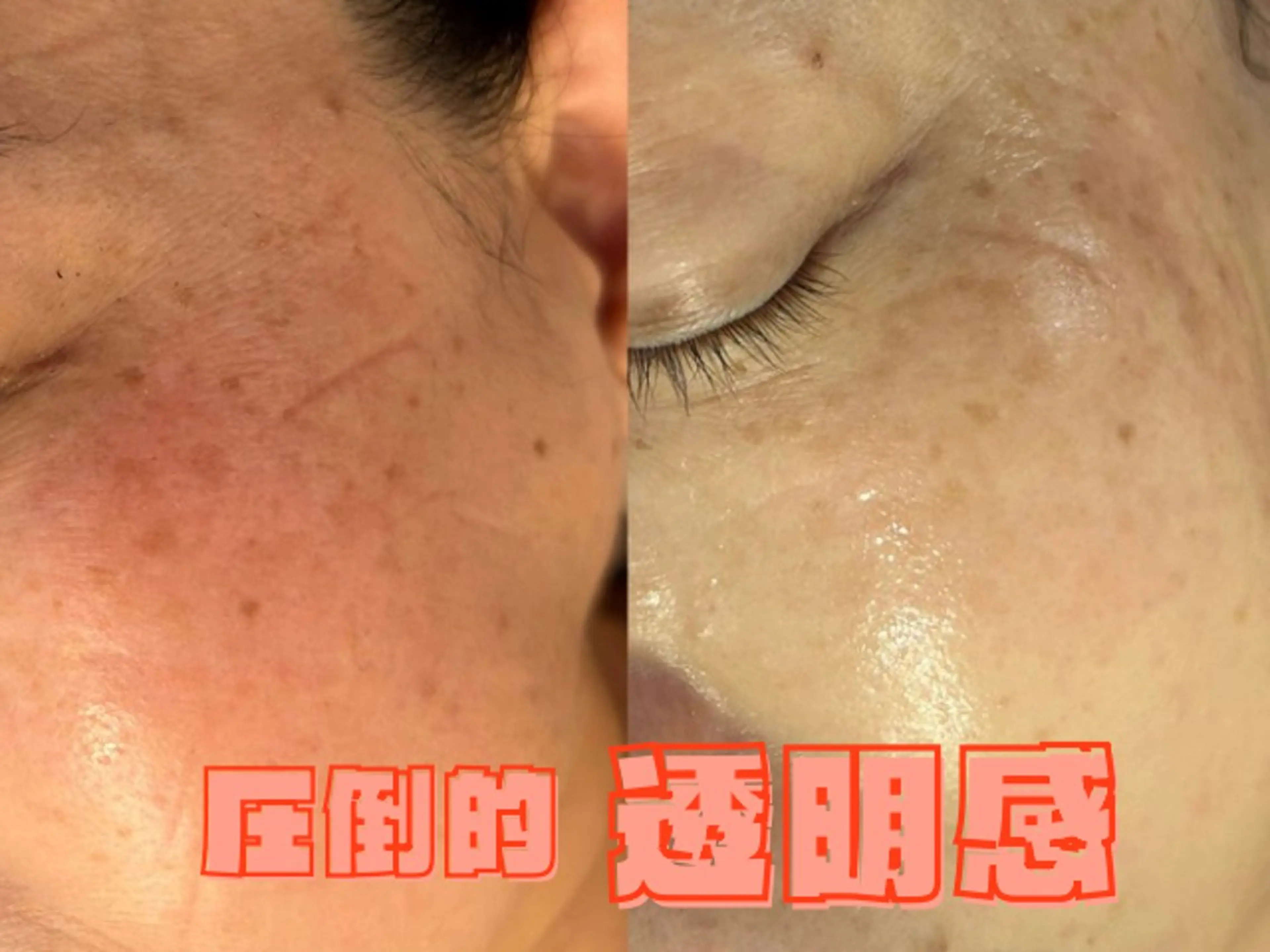 韓国肌管理ララピール クリスタルビューティのエステ・リラクイメージ