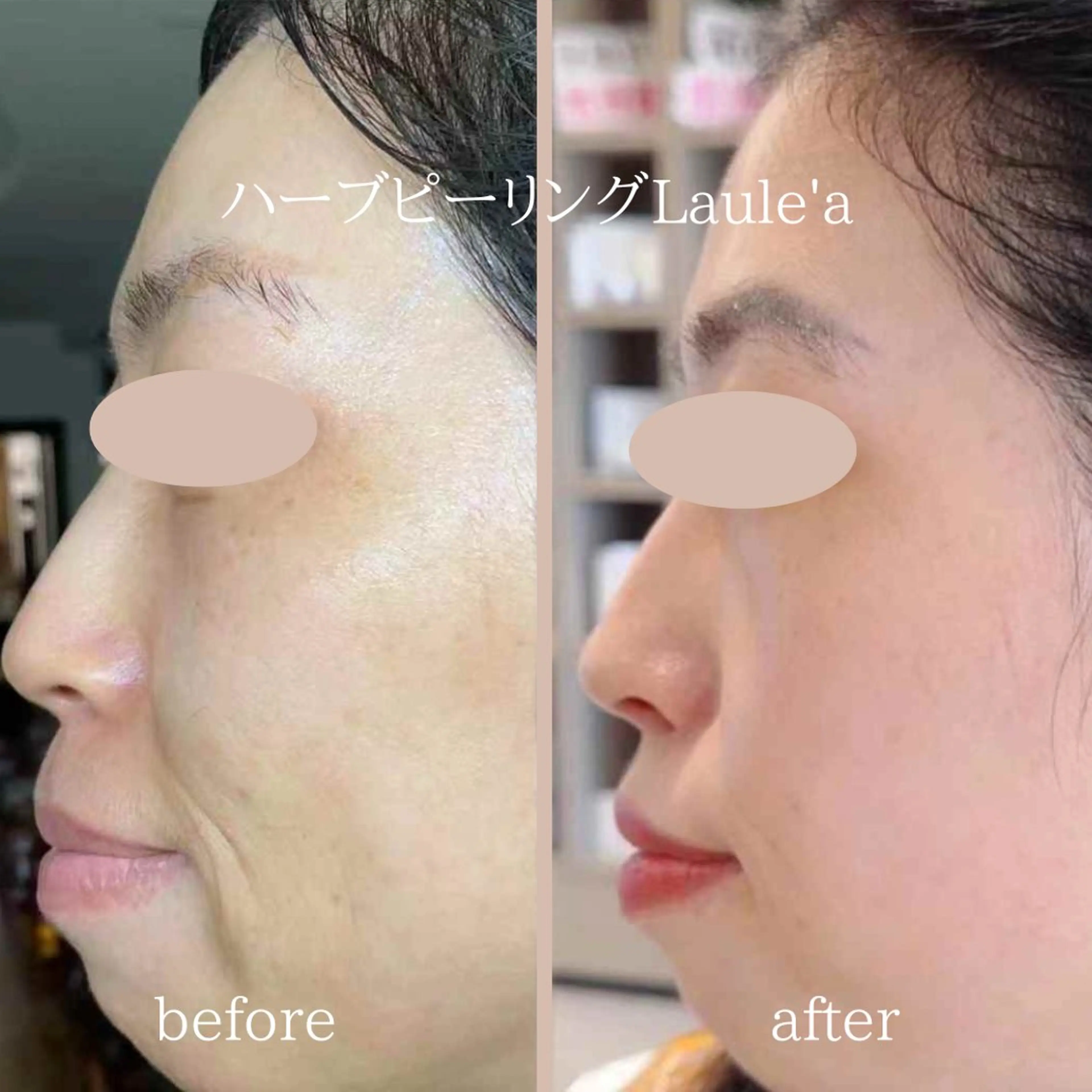 美腸サロン🌺 腸もみ/小顔/リンパのエステ・リラクイメージ