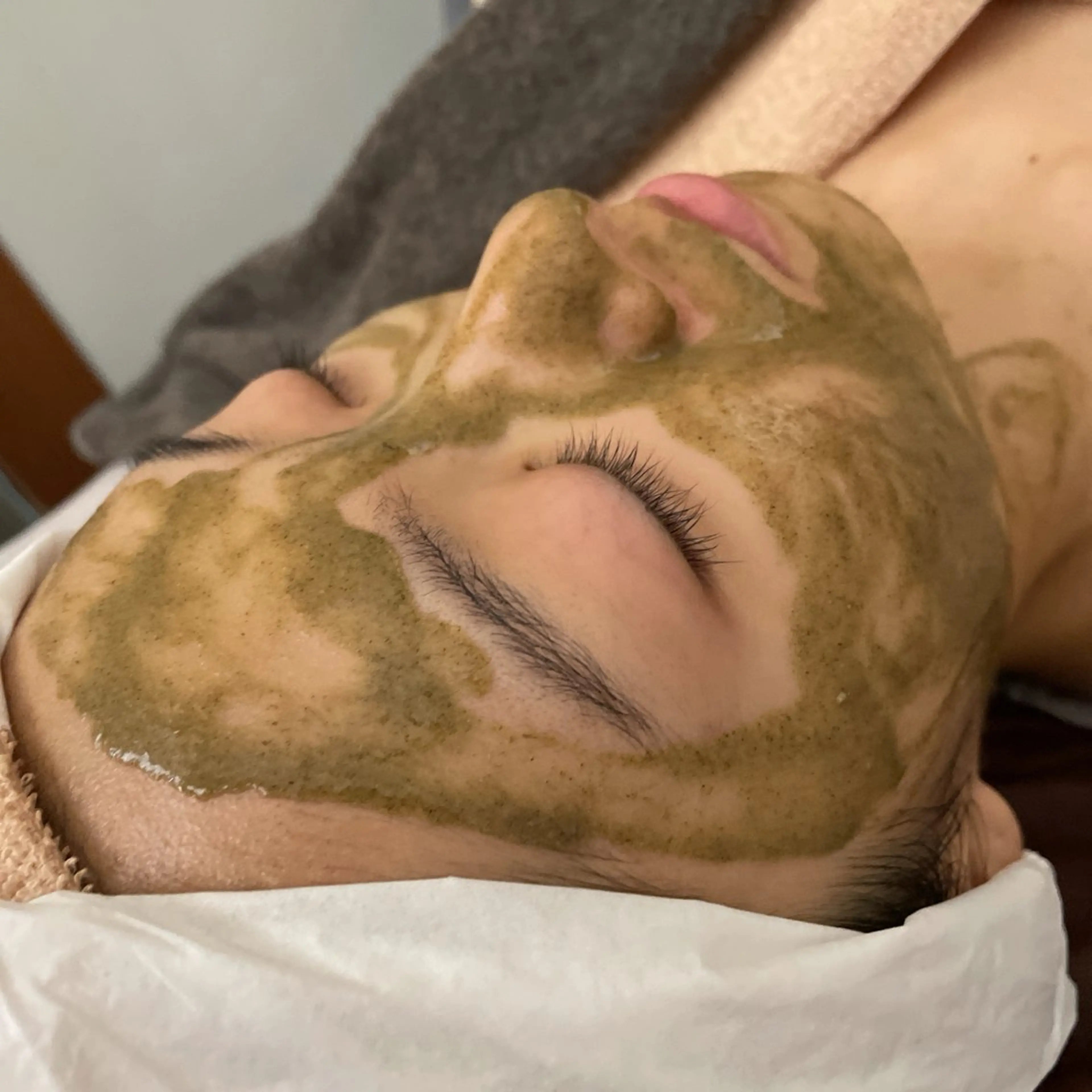 【ミニモ限定】剥離なしハーブピーリングの写真