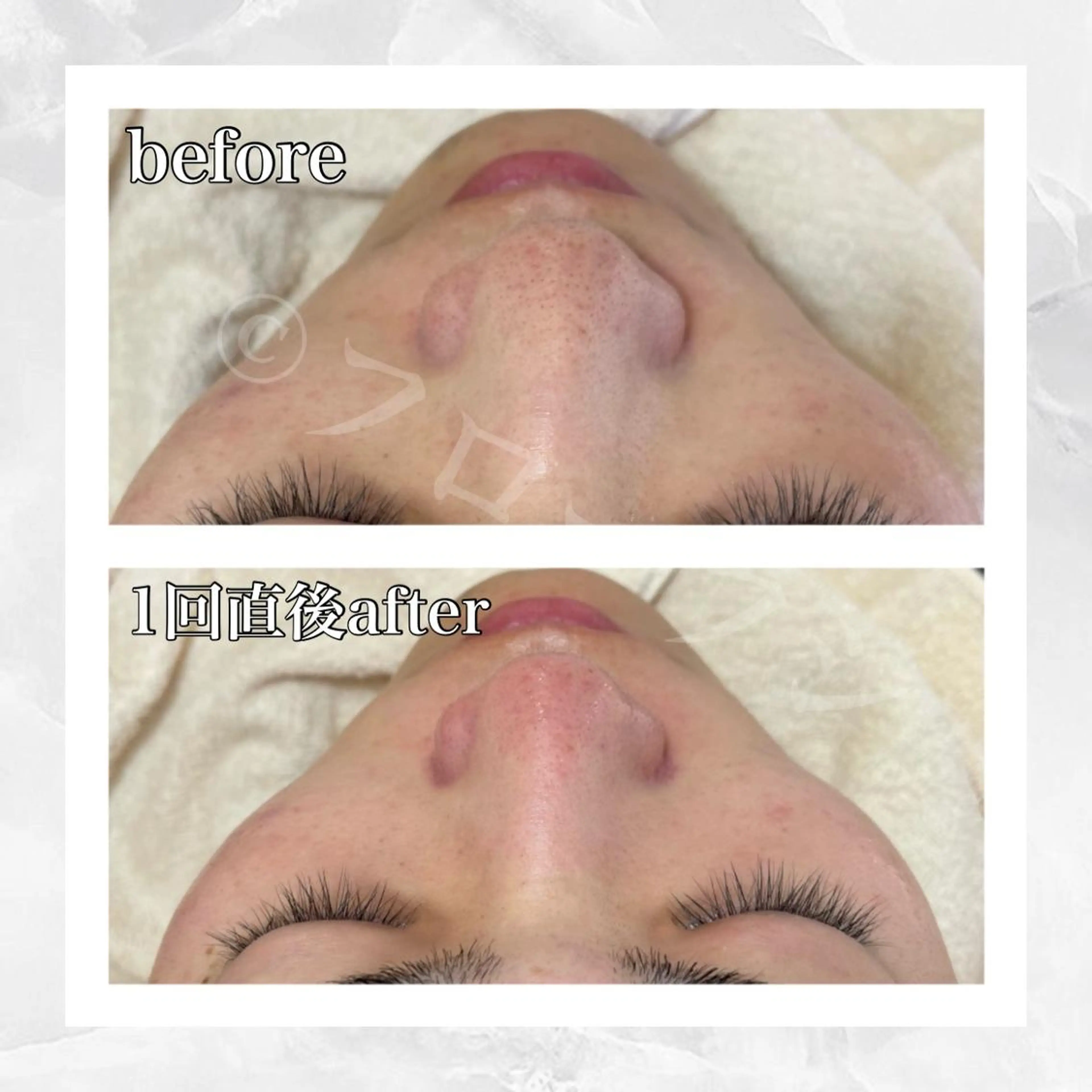 部分痩せ♥️小顔専門 MIKUのエステ・リラクイメージ