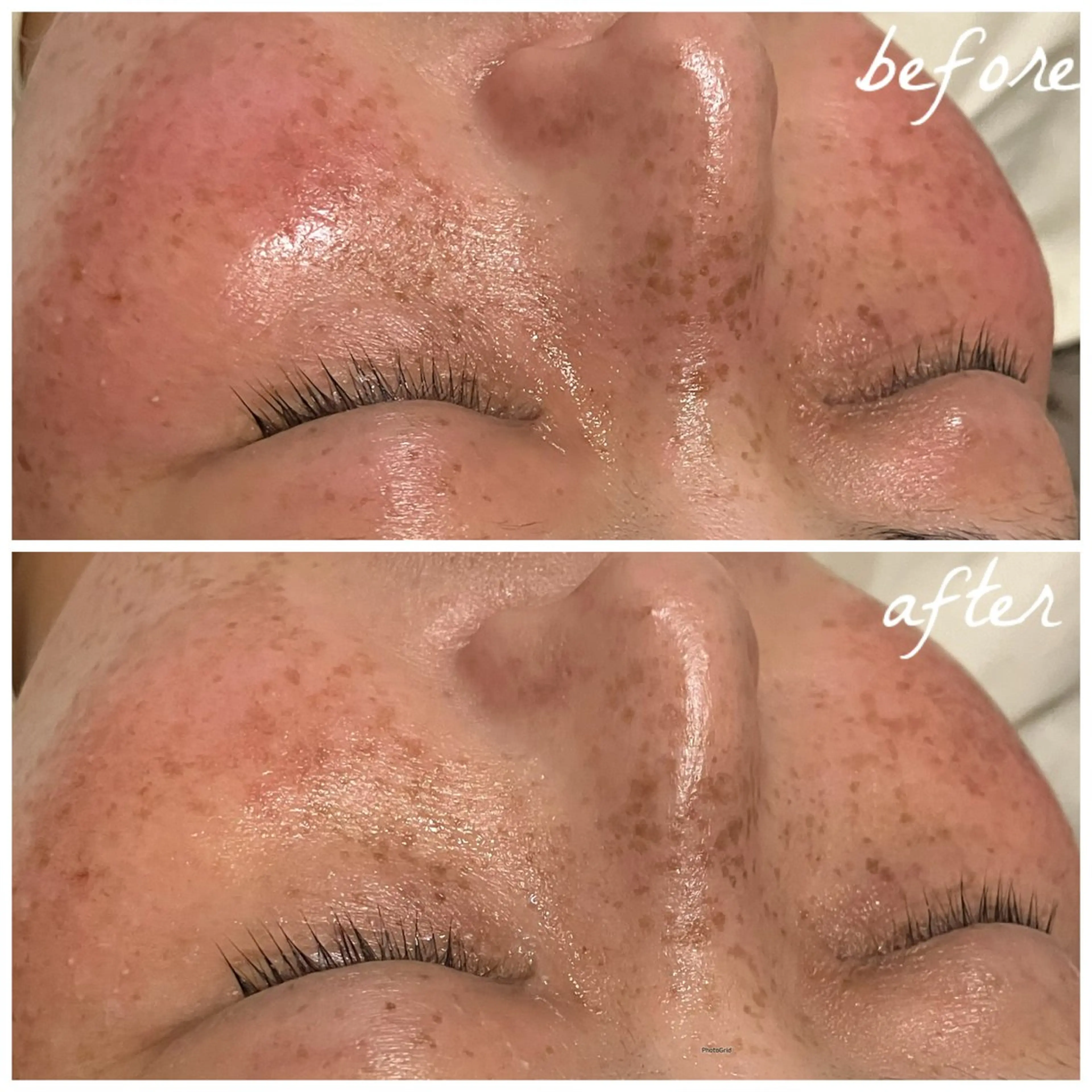 メンズ エステ メナード岐阜市茜部 杉浦のエステ・リラクイメージ