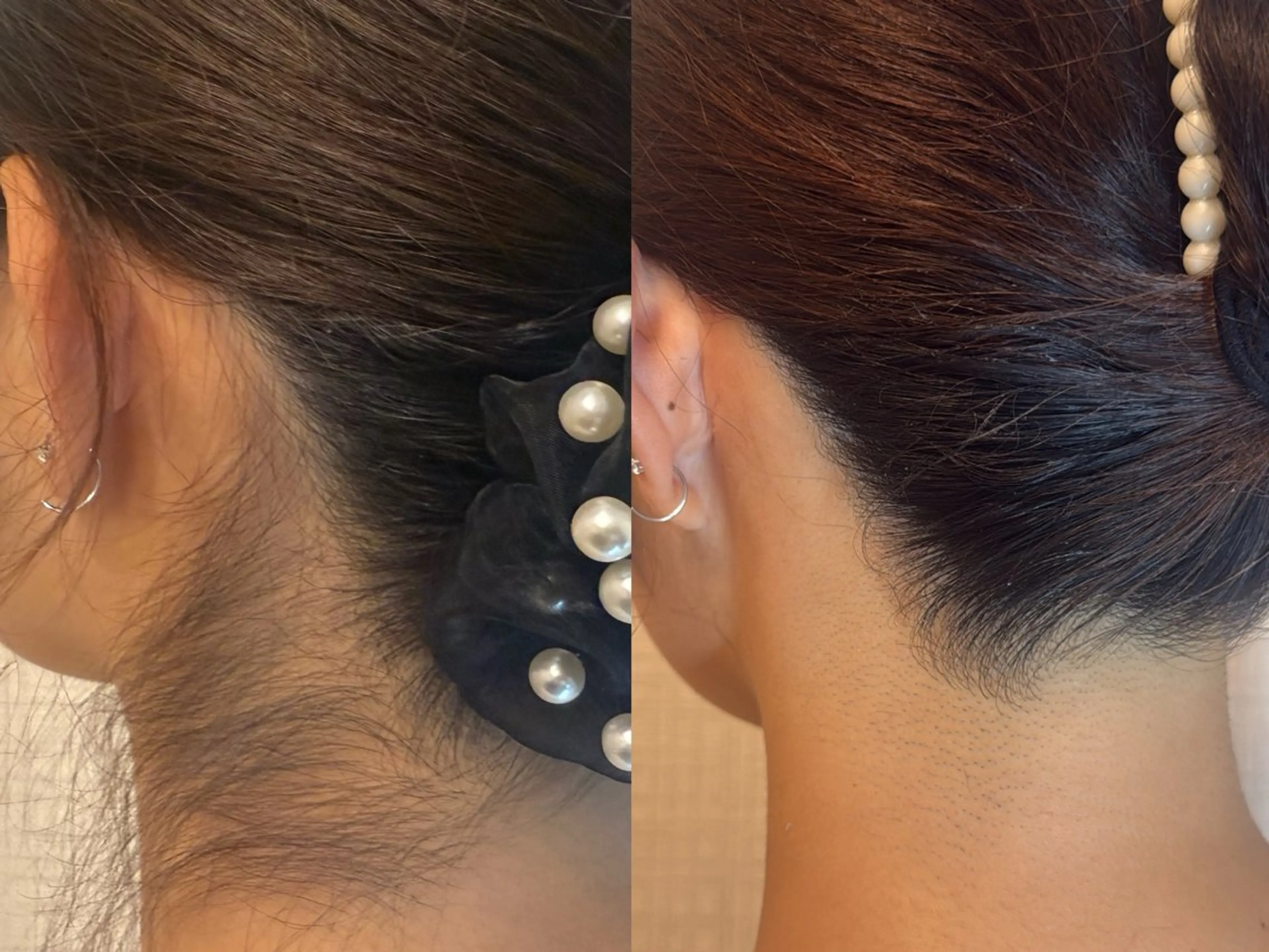 脱毛 Monart -deux-のエステ・リラクイメージ