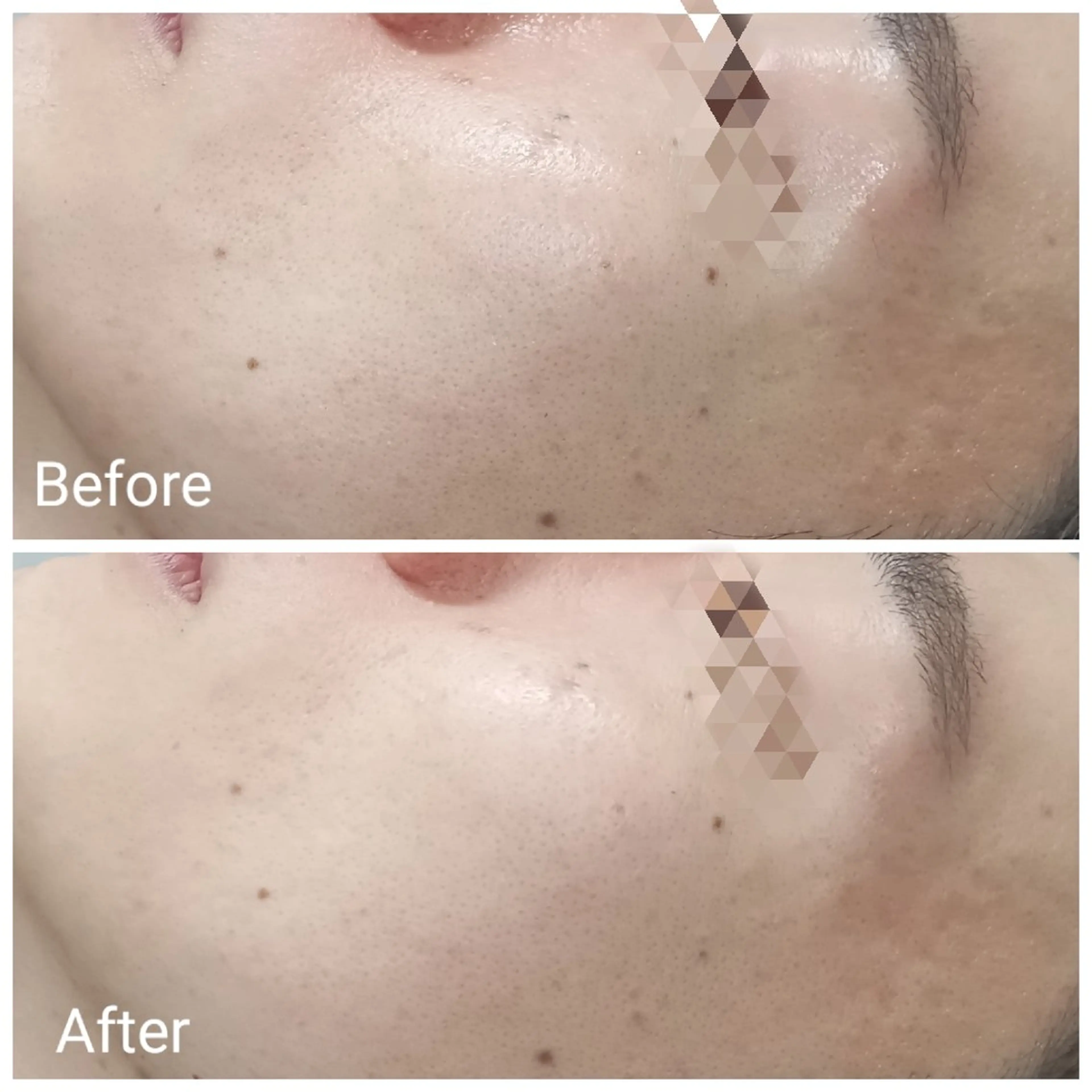 肌質改善Beauty salon Renのエステ・リラクイメージ