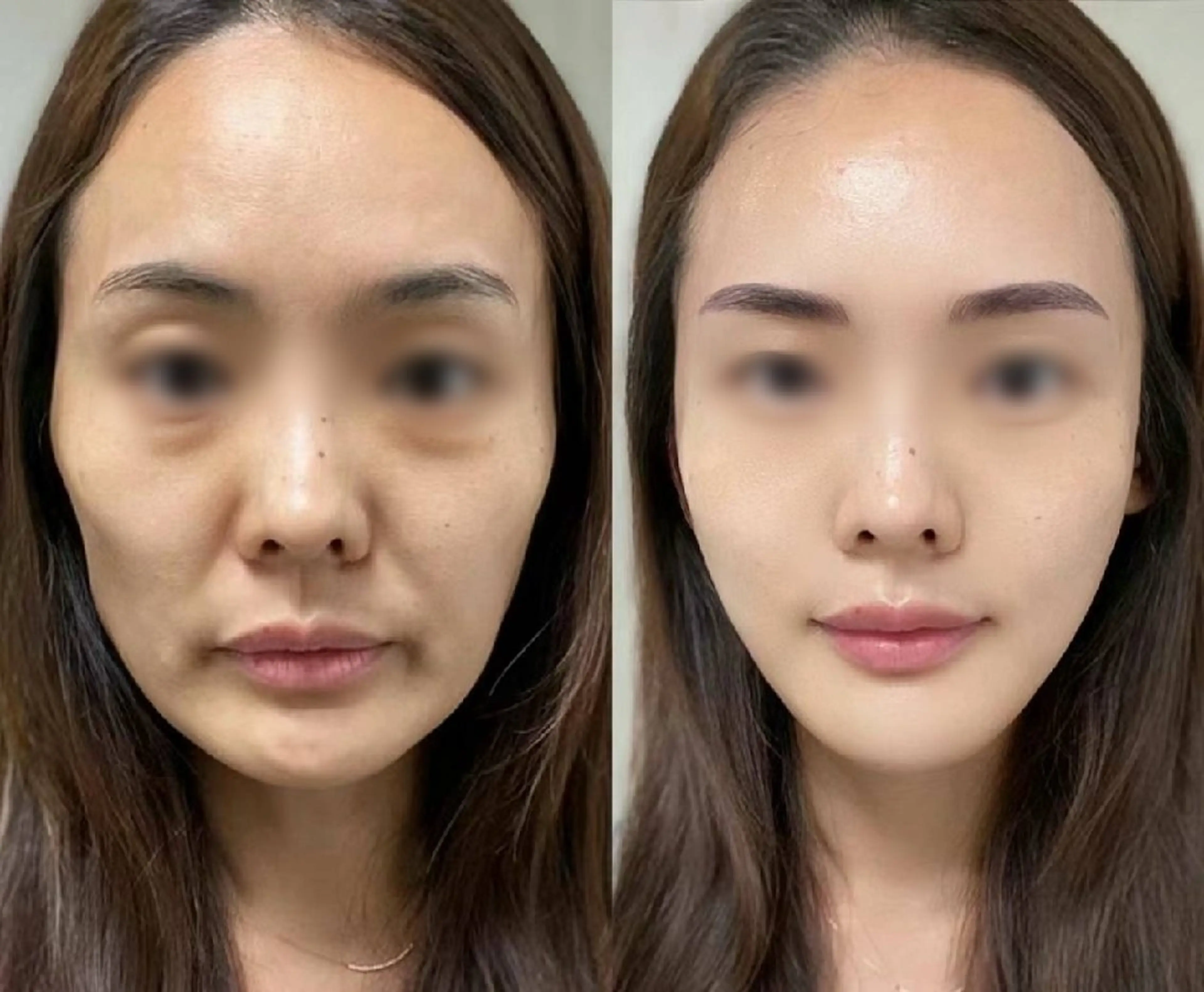 ネイル ブライダルネイル ホワイト aliaハイフ&水光ジェットサロン所属・aliaハーブ水光店 エステティシャン募集のエステ・リラクイメージ