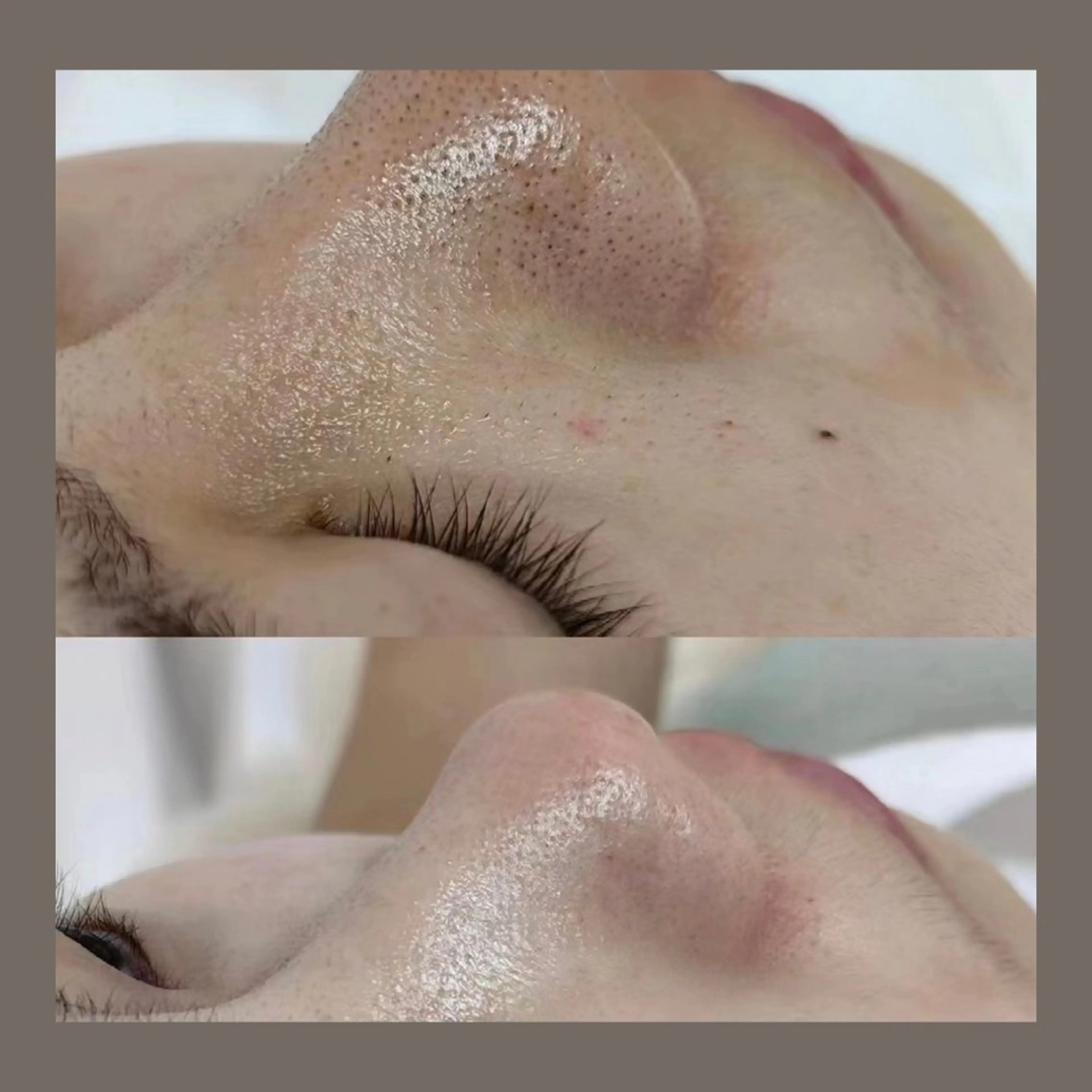 エステ リラク 愛維美水光美肌専門店所属・愛維美水光美肌専門店 メンズレディースokのエステ・リラクイメージ